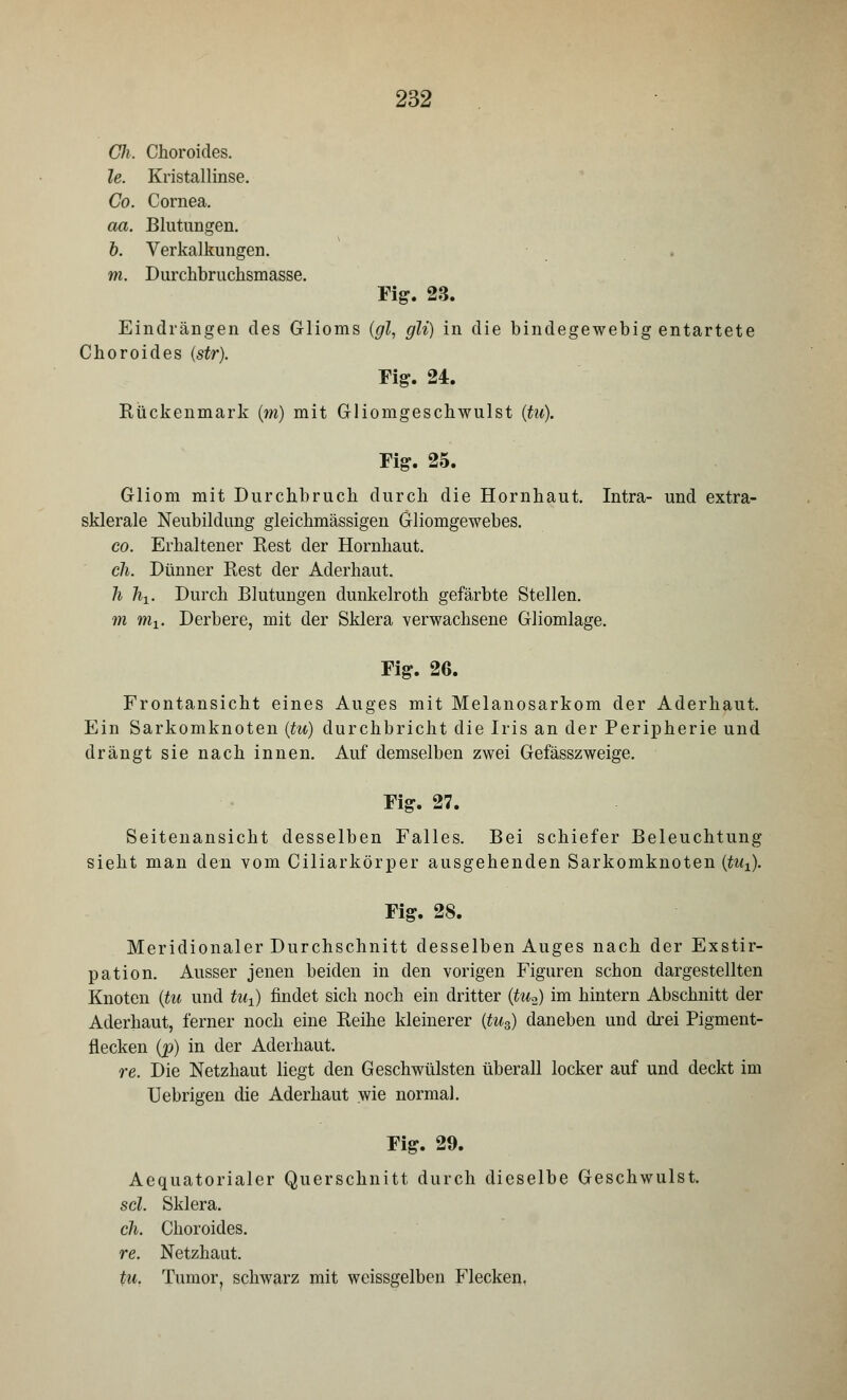 Cli. Choroides. le. Kristallinse. Co. Cornea. aa. Blutungen. b. Verkalkungen. m. Durchbruchsmasse. Fig. 23. Eindrängen des Glioms (gl, gli) in die bindegewebig entartete Choroides (str). Fig. 24. Rückenmark (m) mit Gliomgeschwulst (tu). Fig. 25. Gliom mit Durchbruch durch die Hornhaut. Intra- und extra- sklerale Neubildung gleichmässigen Gliomgewebes. co. Erhaltener Rest der Hornhaut. eh. Dünner Rest der Aderhaut. h hx. Durch Blutungen dunkelroth gefärbte Stellen. m mx. Derbere, mit der Sklera verwachsene Gliomlage. Fig. 26. Frontansicht eines Auges mit Melanosarkom der Aderhaut. Ein Sarkomknoten (tu) durchbricht die Iris an der Peripherie und drängt sie nach innen. Auf demselben zwei Gefässzweige. Fig. 27. Seitenansicht desselben Falles. Bei schiefer Beleuchtung sieht man den vom Ciliarkörper ausgehenden Sarkomknoten (tux). Fig. 28. Meridionaler Durchschnitt desselben Auges nach der Exstir- pation. Ausser jenen beiden in den vorigen Figuren schon dargestellten Knoten (tu und tuj) findet sich noch ein dritter (tu2) im hintern Abschnitt der Aderhaut, ferner noch eine Reihe kleinerer (tu3) daneben und drei Pigment- flecken (p) in der Aderhaut. re. Die Netzhaut liegt den Geschwülsten überall locker auf und deckt im Uebrigen die Aderhaut wie normal. Fig. 29. Aequatorialer Querschnitt durch dieselbe Geschwulst. sei. Sklera. eh. Choroides. re. Netzhaut. tu. Tumor, schwarz mit weissgelben Flecken.