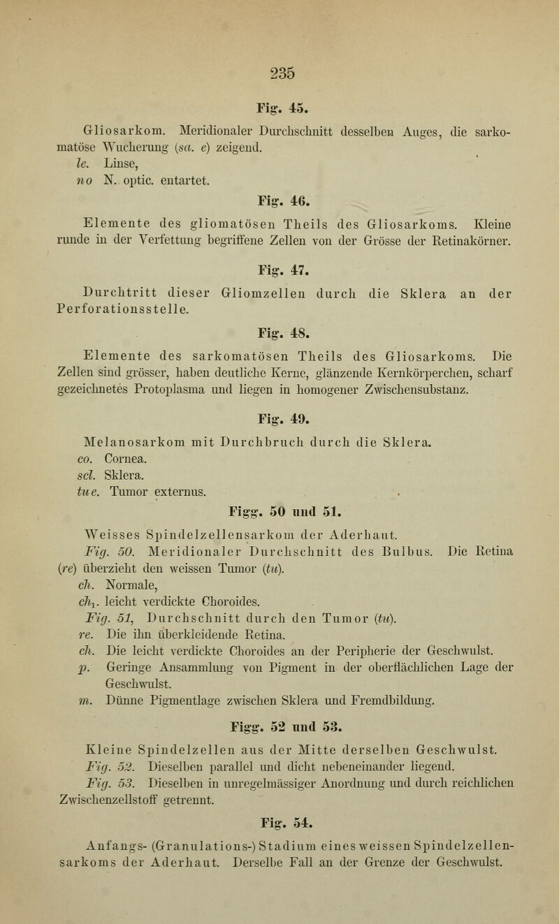 Fig. 45. Gliosarkom. Meridionaler Durchschnitt desselben Auges, die sarko- matöse Wucherung (sa. e) zeigend. le. Linse, no N. optic. entartet. Fig. 46. Elemente des gliomatösen Theils des Gliosarkoms. Kleine runde in der Verfettung begriffene Zellen von der Grösse der Retinakörner. Fig. 47. Durchtritt dieser Gliomzellen durch die Sklera an der Perforationsstelle. Fig. 48. Elemente des sarkomatösen Theils des Gliosarkoms. Die Zellen sind grösser, haben deutliche Kerne, glänzende Kernkörperchen, scharf gezeichnetes Protoplasma und liegen in homogener Zwischensubstanz. Fig. 49. Melanosarkom mit Durchbruch durch die Sklera. co. Cornea. sei. Sklera. tue. Tumor externus. Figg. 50 mid 51. Weisses Spindelzellensarkom der Aderhaut. Fig. 50. Meridionaler Durchschnitt des Bulbus. Die Retina (re) überzieht den weissen Tumor (tu), cli. Normale, c\ix. leicht verdickte Choroides. Fig. 51, Durchschnitt durch den Tumor (tu), re. Die ihn überkleidende Retina. eh. Die leicht verdickte Choroides an der Peripherie der Geschwulst. X>. Geringe Ansammlung von Pigment in der oberflächlichen Lage der Geschwulst. m. Dünne Pigmentlage zwischen Sklera und Fremdbildung. Figg. 52 und 53. Kleine Spindelzellen aus der Mitte derselben Geschwulst. Fig. 52. Dieselben parallel und dicht nebeneinander liegend. Fig. 53. Dieselben in unregelmässiger Anordnung und durch reichlichen Zwischenzellstoff getrennt. Fig. 54. Anfangs- (Granulations-) Stadium eines weissen Spindelzellen- sarkoms der Aderhaut. Derselbe Fall an der Grenze der Geschwulst.