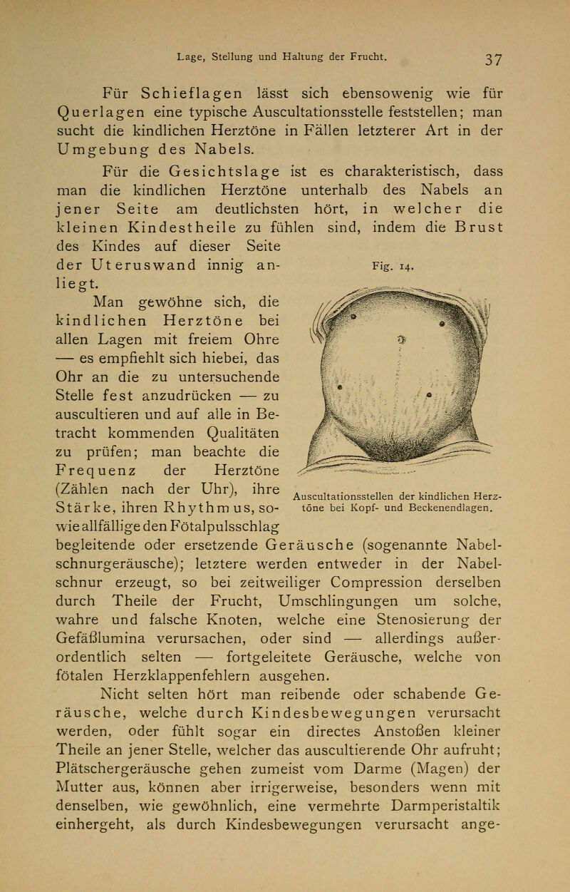 Für Schieflagen lässt sich ebensowenig wie für Querlagen eine typische Auscultationsstelle feststellen; man sucht die kindlichen Herztöne in Fällen letzterer Art in der Umgebung des Nabels. Für die Gesichtslage ist es charakteristisch, dass man die kindlichen Herztöne unterhalb des Nabels an jener Seite am deutlichsten hört, in welcher die kleinen Kindestheile zu fühlen sind, indem die Brust des Kindes auf dieser Seite der Uteruswand innig an- Fig. 14. liegt. Man gewöhne sich, die kindlichen Herztöne bei allen Lagen mit freiem Ohre — es empfiehlt sich hiebei, das Ohr an die zu untersuchende Stelle fest anzudrücken — zu auscultieren und auf alle in Be- tracht kommenden Qualitäten zu prüfen; man beachte die Frequenz der Herztöne (Zählen nach der Uhr), ihre Stärke, ihren Rhythmus, so- wie allfällige den Fötalpulsschlag begleitende oder ersetzende Geräusche (sogenannte Nabel- schnurgeräusche); letztere werden entweder in der Nabel- schnur erzeugt, so bei zeitweiliger Compression derselben durch Theile der Frucht, Umschlingungen um solche, wahre und falsche Knoten, welche eine Stenosierung der Gefäßlumina verursachen, oder sind — allerdings außer- ordentlich selten — fortgeleitete Geräusche, welche von fötalen Herzklappenfehlern ausgehen. Nicht selten hört man reibende oder schabende Ge- räusche, welche durch Kindesbewegungen verursacht werden, oder fühlt sogar ein directes Anstoßen kleiner Theile an jener Stelle, welcher das auscultierende Ohr aufruht; Plätschergeräusche gehen zumeist vom Darme (Magen) der Mutter aus, können aber irrigerweise, besonders wenn mit denselben, wie gewöhnlich, eine vermehrte Darmperistaltik einhergeht, als durch Kindesbewegungen verursacht ange- Auscultationsstellen der kindlichen Herz- töne bei Kopf- und Beckenendlagen.