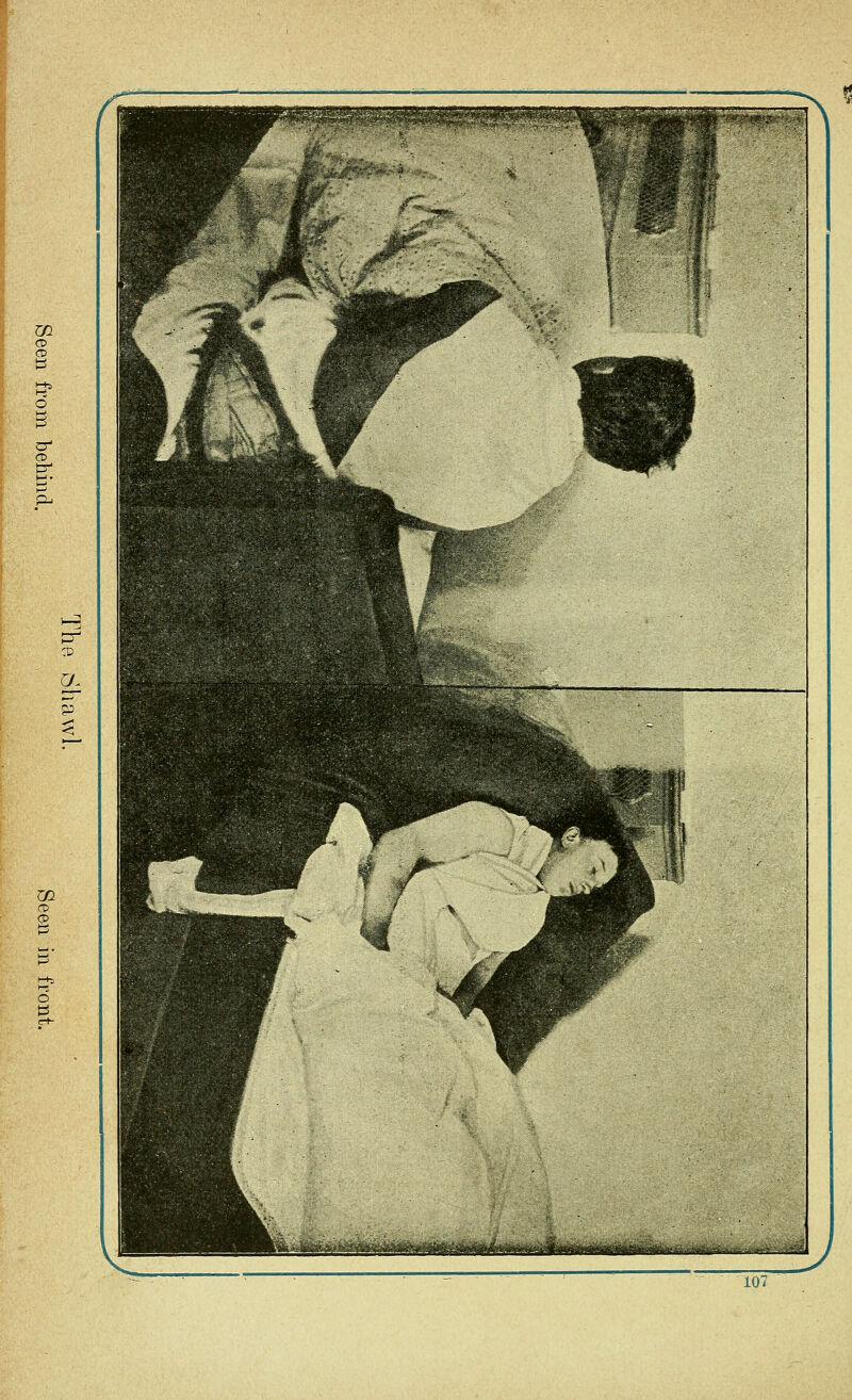 107