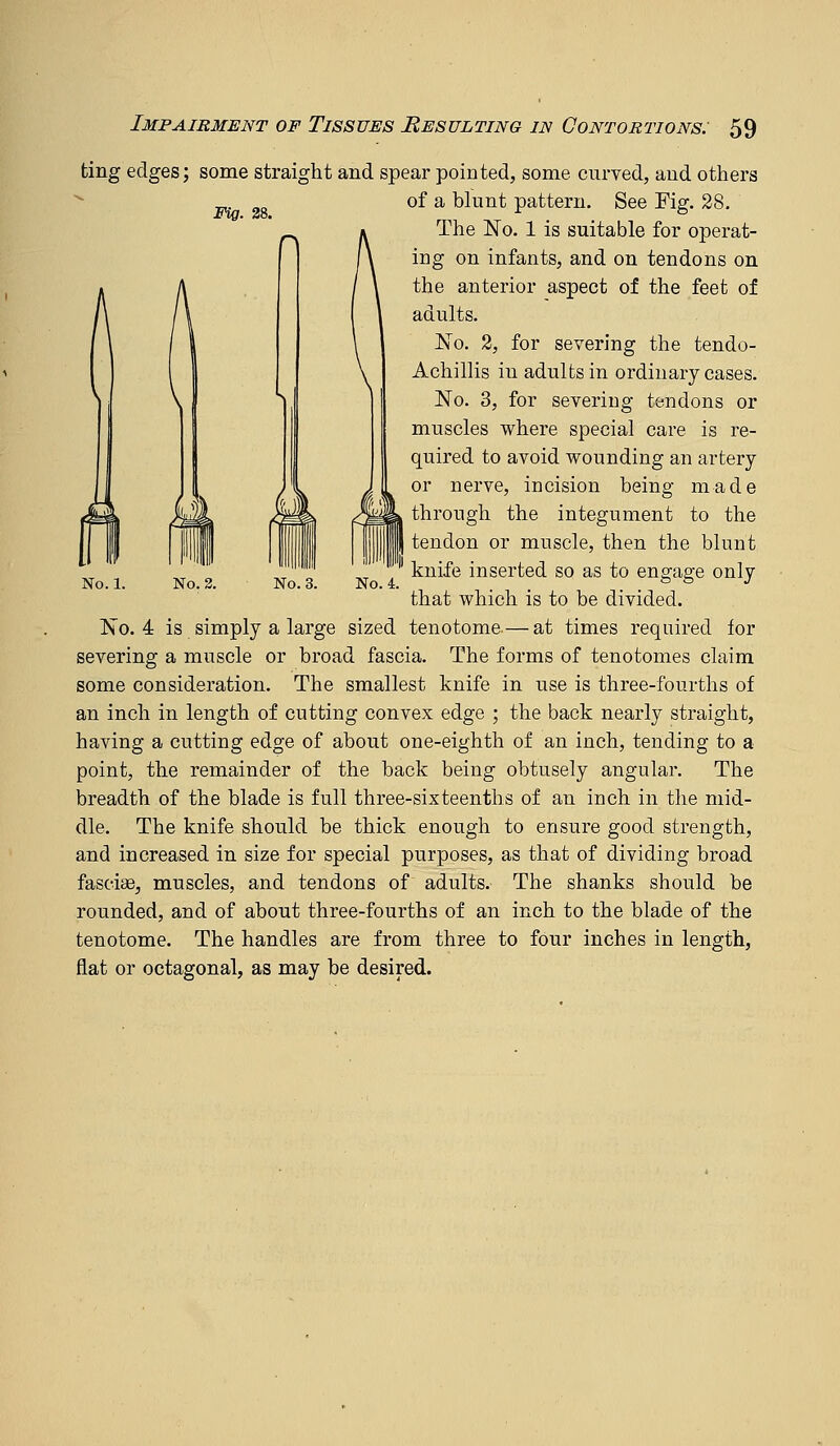 Fig. 28. ting edges; some straight and spear pointed, some curved, and others of a blunt pattern. See Fig. 28. The No. 1 is suitable for operat- ing on infants, and on tendons on the anterior aspect of the feet of adults. No. 2, for severing the tendo- Achillis in adults in ordinary cases. No. 3, for severing tendons or muscles where special care is re- quired to avoid wounding an artery or nerve, incision being made through the integument to the tendon or muscle, then the blunt knife inserted so as to engage only that which is to be divided. No. 4 is simply a large sized tenotome-—at times required for severing a muscle or broad fascia. The forms of tenotomes claim some consideration. The smallest knife in use is three-fourths of an inch in length of cutting convex edge ; the back nearly straight, having a cutting edge of about one-eighth of an inch, tending to a point, the remainder of the back being obtusely angular. The breadth of the blade is full three-sixteenths of an inch in the mid- dle. The knife should be thick enough to ensure good strength, and increased in size for special purposes, as that of dividing broad fasoise, muscles, and tendons of adults. The shanks should be rounded, and of about three-fourths of an inch to the blade of the tenotome. The handles are from three to four inches in length, flat or octagonal, as may be desired. No. 2. No. 3. No. 4.