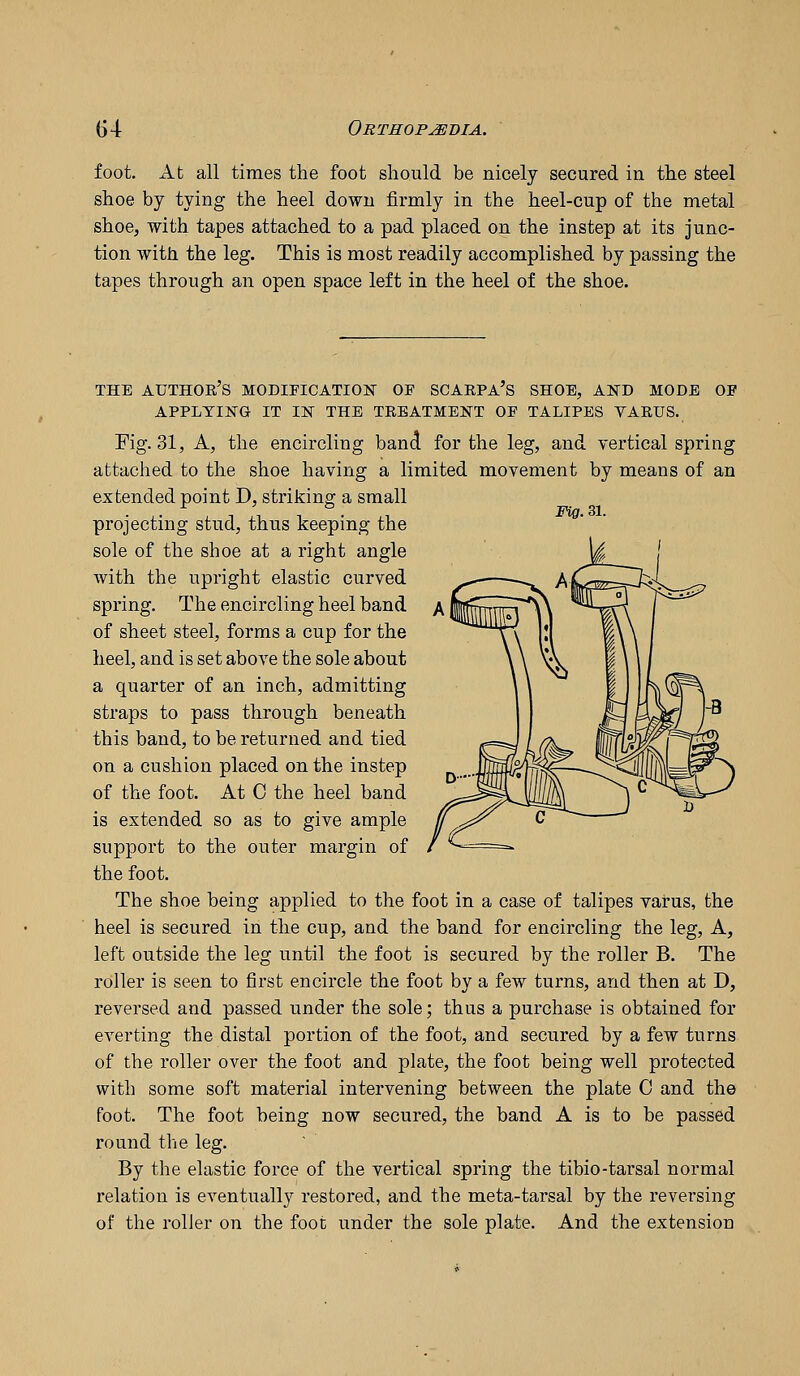 foot. At all times the foot should be nicely secured in the steel shoe by tying the heel down firmly in the heel-cup of the metal shoe, with tapes attached to a pad placed on the instep at its junc- tion with the leg. This is most readily accomplished by passing the tapes through an open space left in the heel of the shoe. THE AUTHOE S MODIFICATION OF SCARPA'S SHOE, AND MODE OF APPLYING IT IN THE TREATMENT OF TALIPES YARUS. Fig. 31, A, the encircling band for the leg, and vertical spring attached to the shoe having a limited movement by means of an extended point D, striking a small projecting stud, thus keeping the sole of the shoe at a right angle with the upright elastic curved spring. The encircling heel band of sheet steel, forms a cup for the heel, and is set above the sole about a quarter of an inch, admitting straps to pass through beneath this band, to be returned and tied on a cushion placed on the instep of the foot. At 0 the heel band is extended so as to give ample support to the outer margin of the foot. The shoe being applied to the foot in a case of talipes varus, the heel is secured in the cup, and the band for encircling the leg, A, left outside the leg until the foot is secured by the roller B. The roller is seen to first encircle the foot by a few turns, and then at D, reversed and passed under the sole; thus a purchase is obtained for everting the distal portion of the foot, and secured by a few turns of the roller over the foot and plate, the foot being well protected with some soft material intervening between the plate C and the foot. The foot being now secured, the band A is to be passed round the leg. By the elastic force of the vertical spring the tibio-tarsal normal relation is eventually restored, and the meta-tarsal by the reversing of the roller on the foot under the sole plate. And the extension