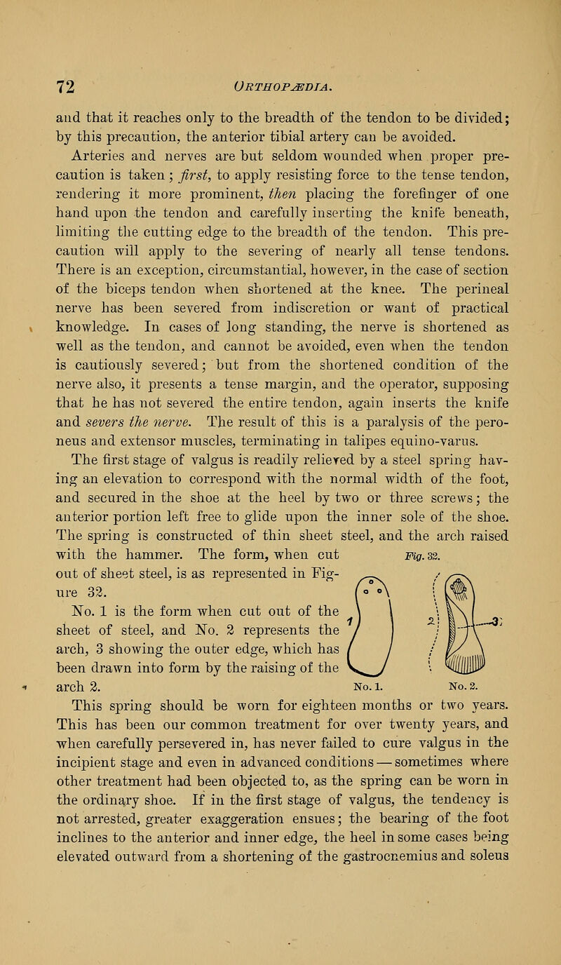 and that it reaches only to the breadth of the tendon to be divided; by this precaution, the anterior tibial artery can be avoided. Arteries and nerves are but seldom wounded when proper pre- caution is taken ; first, to apply resisting force to the tense tendon, rendering it more prominent, tlien placing the forefinger of one hand upon the tendon and carefully inserting the knife beneath, limiting the cutting edge to the breadth of the tendon. This pre- caution will apply to the severing of nearly all tense tendons. There is an exception, circumstantial, however, in the case of section of the biceps tendon when shortened at the knee. The perineal nerve has been severed from indiscretion or want of practical knowledge. In cases of long standing, the nerve is shortened as well as the tendon, and cannot be avoided, even when the tendon is cautiously severed; but from the shortened condition of the nerve also, it presents a tense margin, and the operator, supposing that he has not severed the entire tendon, again inserts the knife and severs the nerve. The result of this is a paralysis of the pero- neus and extensor miiscles, terminating in talipes equino-varus. The first stage of valgus is readily relieved by a steel spring hav- ing an elevation to correspond with the normal width of the foot, and secured in the shoe at the heel by two or three screws; the anterior portion left free to glide upon the inner sole of the shoe. The spring is constructed of thin sheet steel, and the arch raised with the hammer. The form, when cut mg.Z2. out of sheet steel, is as represented in Fig- ure 32. No. 1 is the form when cut out of the sheet of steel, and No. 2 represents the arch, 3 showing the outer edge, which has been drawn into form by the raising of the arch 2. No. l. No. 3. This spring should be worn for eighteen months or two years. This has been our common treatment for over twenty years, and when carefully persevered in, has never failed to cure valgus in the incipient stage and even in advanced conditions — sometimes where other treatment had been objected to, as the spring can be worn in the ordinary shoe. If in the first stage of valgus, the tendency is not arrested, greater exaggeration ensues; the bearing of the foot Inclines to the anterior and inner edge, the heel in some cases being elevated outward from a shortening of the gastrocnemius and soleus