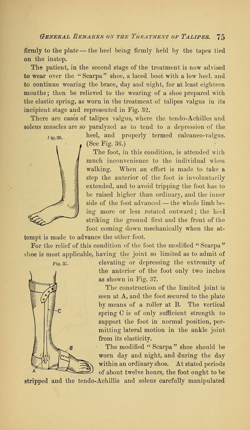 rifif.36. firmly to the plate — the heel being firmly held by the tapes tied on the instep. The patient, in the second stage of the treatment is now advised to wear over the  Scarpa shoe, a laced boot with a low heel, and to continue wearing the brace, day and night, for at least eighteen months; then be relieved to the wearing of a shoe prepared with the elastic spring, as worn in the treatment of talipes valgus in its incipient stage and represented in Fig. 32. There are cases of talipes valgus, where the tendo-Achilles and soleus muscles are so paralyzed as to tend to a depression of the heel, and properly termed calcaneo-valgus. (See Fig. 36.) The foot, in this condition, is attended with much inconvenience to the individual when walking. When an eflPort is made to take a step the anterior of the foot is involuntarily extended, and to avoid tripping the foot has to be raised higher than ordinary, and the inner side of the foot advanced — the whole limb be- ing more or less rotated outward; the heel striking the ground first and the front of the foot coming down mechanically when the at- tempt is made to advance the other foot. For the relief of this condition of the foot the modified  Scarpa  shoe is most applicable, having the joint so limited as to admit of Fiy.Ki. elevating or depressing the extremity of the anterior of the foot only two inches as shown in Fig. 37. The construction of the limited joint is seen at A, and the foot secured to the plate by means of a roller at B. The vertical spring C is of only sufficient strength to support the foot in normal position, per- mitting lateral motion in the ankle joint from its elasticity. The modified  Scarpa  shoe should be worn day and night, and during the day within an ordinary shoe. At stated periods of about twelve hours, the foot ought to be stripped and the tendo-Achillis and soleus carefully manipulated