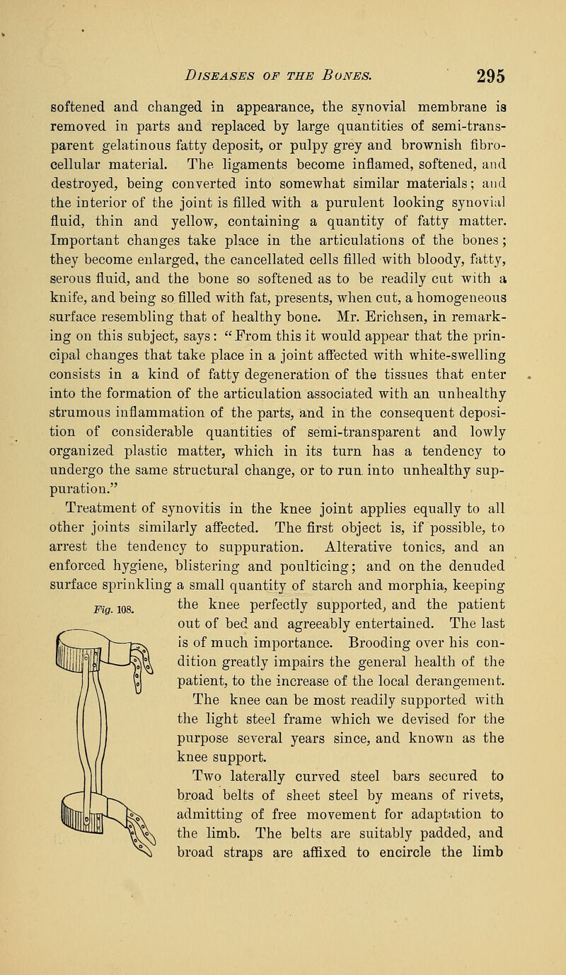 softened and changed in appearance, the synovial membrane is removed in parts and replaced by large quantities of semi-trans- parent gelatinous fatty deposit, or pulpy grey and brownish fibro- cellular material. The ligaments become inflamed, softened, and destroyed, being converted into somewhat similar materials; and the interior of the joint is filled with a purulent looking synovial fluid, thin and yellow, containing a quantity of fatty matter. Important changes take place in the articulations of the bones; they become enlarged, the cancellated cells filled with bloody, fatty, serous fluid, and the bone so softened as to be readily cut with a knife, and being so filled with fat, presents, when cut, a homogeneous surface resembling that of healthy bone. Mr. Erichsen, in remark- ing on this subject, says: From this it would appear that the prin- cipal changes that take place in a joint affected with white-swelling consists in a kind of fatty degeneration of the tissues that enter into the formation of the articulation associated with an unhealthy strumous inflammation of the parts, and in the consequent deposi- tion of considerable quantities of serai-transparent and lowly organized plastic matter, which in its turn has a tendency to undergo the same structural change, or to run. into unhealthy sup- puration. Treatment of synovitis in the knee joint applies equally to all other joints similarly affected. The first object is, if possible, to arrest the tendency to suppuration. Alterative tonics, and an enforced hygiene, blistering and poulticing; and on the denuded surface sprinkling a small quantity of starch and morphia, keeping Mg. 108. ^^® knee perfectly supported, and the patient out of bed and agreeably entertained. The last is of much importance. Brooding over his con- dition greatly impairs the general health of the patient, to the increase of the local derangement. The knee can be most readily supported with the light steel frame which we devised for the purpose several years since, and known as the knee support. Two laterally curved steel bars secured to broad belts of sheet steel by means of rivets, admitting of free movement for adaptation to the limb. The belts are suitably padded, and broad straps are aflfixed to encircle the limb