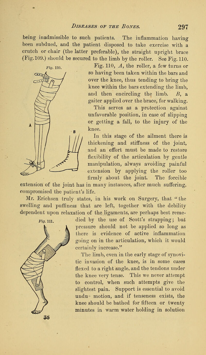 Pig. 110. being inadmissible to such patients. The inflammation having been subdued, and the patient disposed to take exercise with a crutch or chair (the latter preferable), the straight upright brace (Fig. 109.) should be secured to the limb by the roller. See Fig. 110. Fig. 110, A, the roller, a few turns or so having been taken within the bars and over the knee, thus tending to bring the knee within the bars extending the limb, and then encircling the limb. B, a gaiter applied over the brace, for walking. This serves as a protection against unfavorable position, in case of slipping or getting a fall, to the injury of the knee. In this stage of the ailment there is thickening and stiffness of the joint, and an effort must be made to restore flexibility of the articulation by gentle manipulation, always avoiding painful extension by applying the roller too firmly about the joint. The forcible extension of the joint has in many instances, after much suffering, compromised the patient's life. Mr. Erichsen truly states, in his work on Surgery, that the swelling and puflSness that are left, together with the debility dependent upon relaxation of the ligaments, are perhaps best reme- Pig.111. tlied by the use of Scott's strapping; but pressure should not be applied so long as there is evidence of active inflammation going on in the articulation, which it would certainly increase. The limb, even in the early stage of synovi- tic invasion of the knee, is in some cases flexed to a right angle, and the tendons under the knee very tense. This we never attempt to control, when such attempts give the slightest pain. Support is essential to avoid undu^^ motion, and if tenseness exists, the knee should be bathed for fifteen or twenty minutes in warm water holding in solution