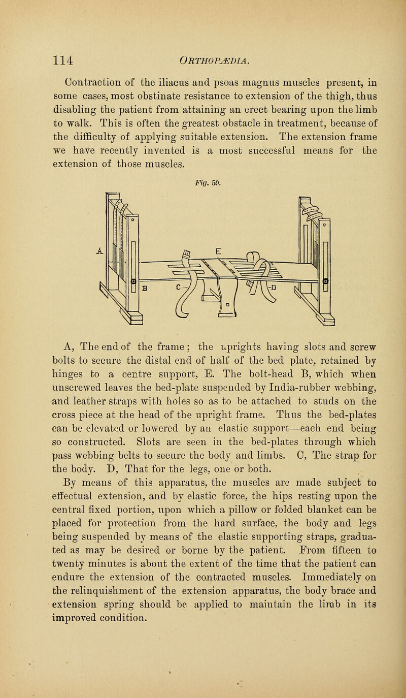 Contraction of the iliacus and psoas magnus muscles present, in some cases, most obstinate resistance to extension of the thigh, thus disabling the patient from attaining an erect bearing upon the limb to walk. This is often the greatest obstacle in treatment, because of the difficulty of applying suitable extension. The extension frame we have recently invented is a most successful means for the extension of those muscles. Fig. 58. A, The end of the frame ; the uprights having slots and screw bolts to secure the distal end of half of the bed plate, retained by hinges to a centre support, E. The bolt-head B, which when unscrewed leaves the bed-plate suspended by India-rubber webbing, and leather straps with holes so as to be attached to studs on the cross piece at the head of the upright frame. Thus the bed-plates can be elevated or lowered by an elastic support—each end being so constructed. Slots are seen in the bed-plates through which pass webbing belts to secure the body and limbs. C, The strap for the body. D, That for the legs, one or both. By means of this apparatus, the muscles are made subject to effectual extension, and by elastic force, the hips resting upon the central fixed portion, upon which a pillow or folded blanket can be placed for protection from the hard surface, the body and legs being suspended by means of the elastic supporting straps, gradua- ted as may be desired or borne by the patient. From fifteen to twenty minutes is about the extent of the time that the patient can endure the extension of the co,ntracted muscles. Immediately on the relinquishment of the extension apparatus, the body brace and extension spring should be applied to maintain the limb in ita improved condition.