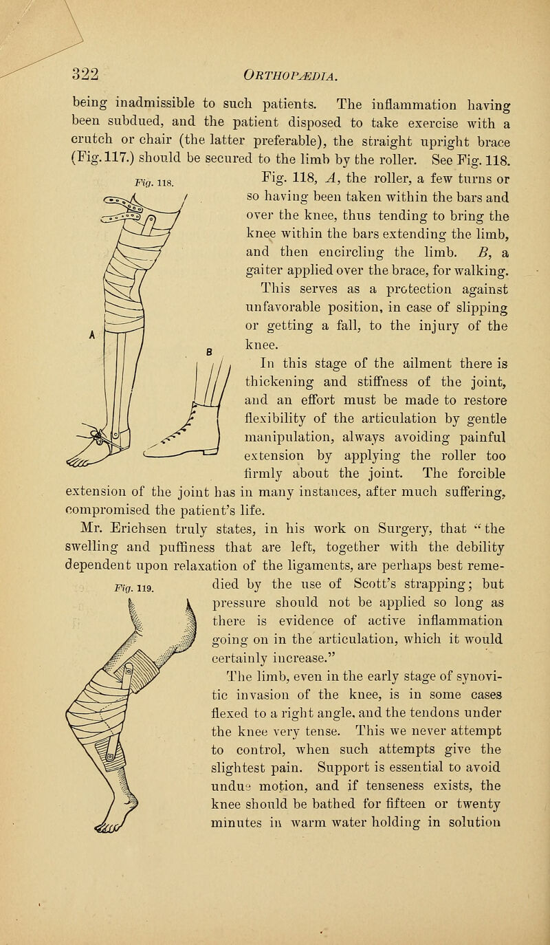 being inadmissible to such patients. The inflammation having been subdued, and the patient disposed to take exercise with a crutch or chair (the latter preferable), the straight upright brace (Fig. 117.) should be secured to the limb by the roller. See Fig. 118. Fig. 118, A, the roller, a few turns or so having been taken within the bars and over the knee, thus tending to bring the knee within the bars extending the limb, FiQ. 118. and then encircling the limb. B, a gaiter applied over the brace, for walking. This serves as a protection against unfavorable position, in case of slipping or getting a fall, to the injury of the knee. In this stage of the ailment there is thickening and stiffness of the joint, and an effort must be made to restore flexibility of the articulation by gentle manipulation, always avoiding painful extension by applying the roller too firmly about the joint. The foi'cible extension of the joint has in many instances, after much suffering, compromised the patient's life. Mr. Erichsen truly states, in his work on Surgery, that '^the swelling and puffiness that are left, together with the debility dependent upon relaxation of the ligaments, are perhaps best reme- Fig. 119. tlied by the use of Scott's strapping; but pressure should not be applied so long as there is evidence of active inflammation going on in the articulation, which it would certainly increase. The limb, even in the early stage of synovi- tic invasion of the knee, is in some cases flexed to a right angle, and the tendons under the knee very tense. This we never attempt to control, when such attempts give the slightest pain. Support is essential to avoid undue motion, and if tenseness exists, the knee should be bathed for fifteen or twenty minutes in Avarm water holding in solution