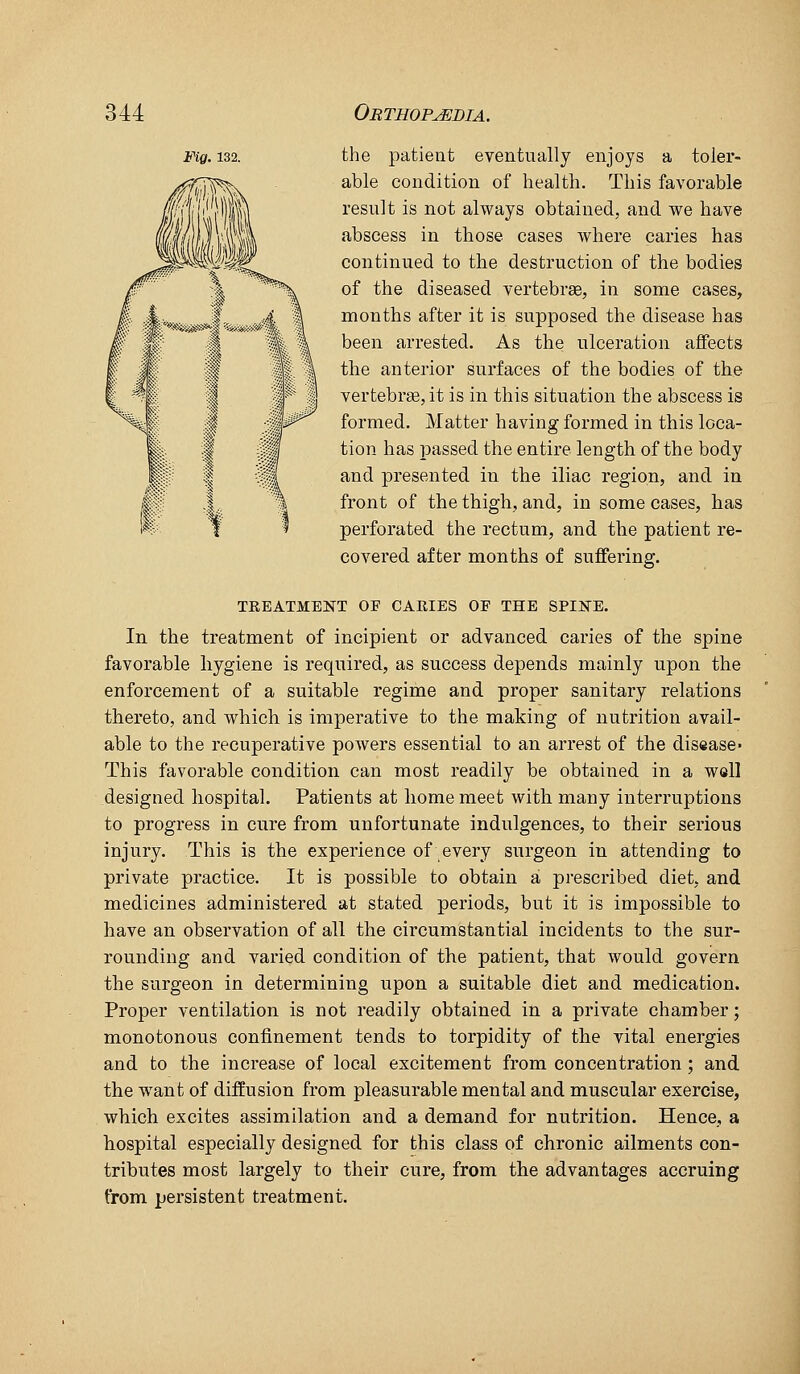 Fig. 132. the patient eventually enjoys a toler- able condition of health. This favorable result is not always obtained, and we have abscess in those cases where caries has continued to the destruction of the bodies of the diseased vertebrae, in some cases, months after it is supposed the disease has been arrested. As the ulceration aflFects the anterior surfaces of the bodies of the vertebr£e,it is in this situation the abscess is formed. Matter having formed in this loca- tion has passed the entire length of the body and presented in the iliac region, and in front of the thigh, and, in some cases, has perforated the rectum, and the patient re- covered after months of suffering. TREATMENT OF CARIES OF THE SPINE. In the treatment of incipient or advanced caries of the spine favorable hygiene is required, as success depends mainly upon the enforcement of a suitable regime and proper sanitary relations thereto, and which is imperative to the making of nutrition avail- able to the recuperative powers essential to an arrest of the disease- This favorable condition can most readily be obtained in a well designed hospital. Patients at home meet with many interruptions to progress in cure from unfortunate indulgences, to their serious injury. This is the experience of every surgeon in attending to private practice. It is possible to obtain a prescribed diet, and medicines administered at stated periods, but it is impossible to have an observation of all the circumstantial incidents to the sur- rounding and varied condition of the patient, that would govern the surgeon in determining upon a suitable diet and medication. Proper ventilation is not readily obtained in a private chamber; monotonous confinement tends to torpidity of the vital energies and to the increase of local excitement from concentration ; and the want of diffusion from pleasurable mental and muscular exercise, which excites assimilation and a demand for nutrition. Hence, a hospital especially designed for this class of chronic ailments con- tributes most largely to their cure, from the advantages accruing from persistent treatment.