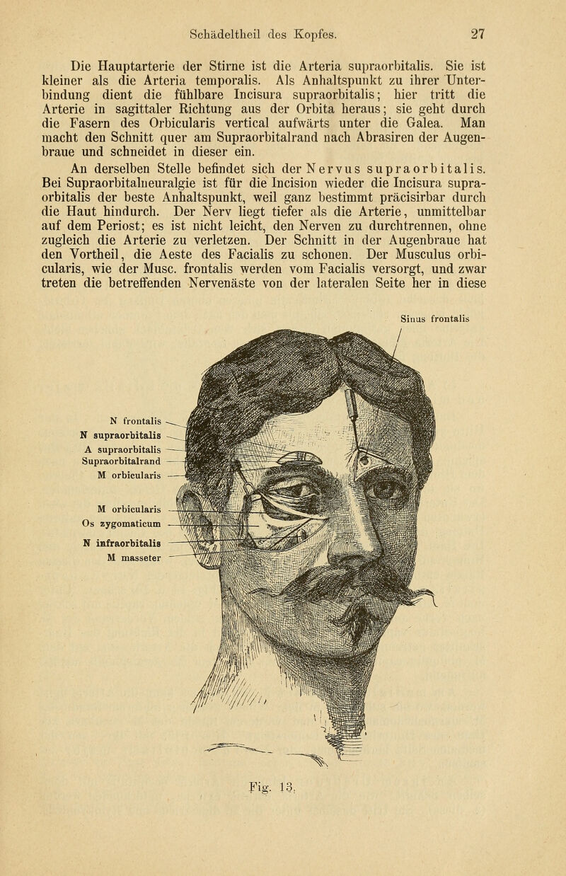 Die Hauptarterie der Stirne ist die Arteria supraorbitalis. Sie ist kleiner als die Arteria temporalis. Als Anhaltspunkt zu ihrer Unter- bindung dient die fühlbare Incisura supraorbitalis; hier tritt die Arterie in sagittaler Richtung aus der Orbita heraus; sie geht durch die Fasern des Orbicularis vertical aufwärts unter die Galea. Man macht den Schnitt quer am Supraorbitalrand nach Abrasiren der Augen- braue und schneidet in dieser ein. An derselben Stelle befindet sich der Nervus supraorbitalis. Bei Supraorbitalneuralgie ist für die Incision wieder die Incisura supra- orbitalis der beste Anhaltspunkt, weil ganz bestimmt präcisirbar durch die Haut hindurch. Der Nerv liegt tiefer als die Arterie, unmittelbar auf dem Periost; es ist nicht leicht, den Nerven zu durchtrennen, ohne zugleich die Arterie zu verletzen. Der Schnitt in der Augenbraue hat den Vortheil, die Aeste des Facialis zu schonen. Der Musculus orbi- cularis, wie der Muse, frontalis werden vom Facialis versorgt, und zwar treten die betreffenden Nervenäste von der lateralen Seite her in diese Sinus frontalis N frontalis N supraorbitalis A supraorbitalis Supraorbitalrand M orbicularis M orbicularis Os zygomaticum N infraorbitalis M masseter