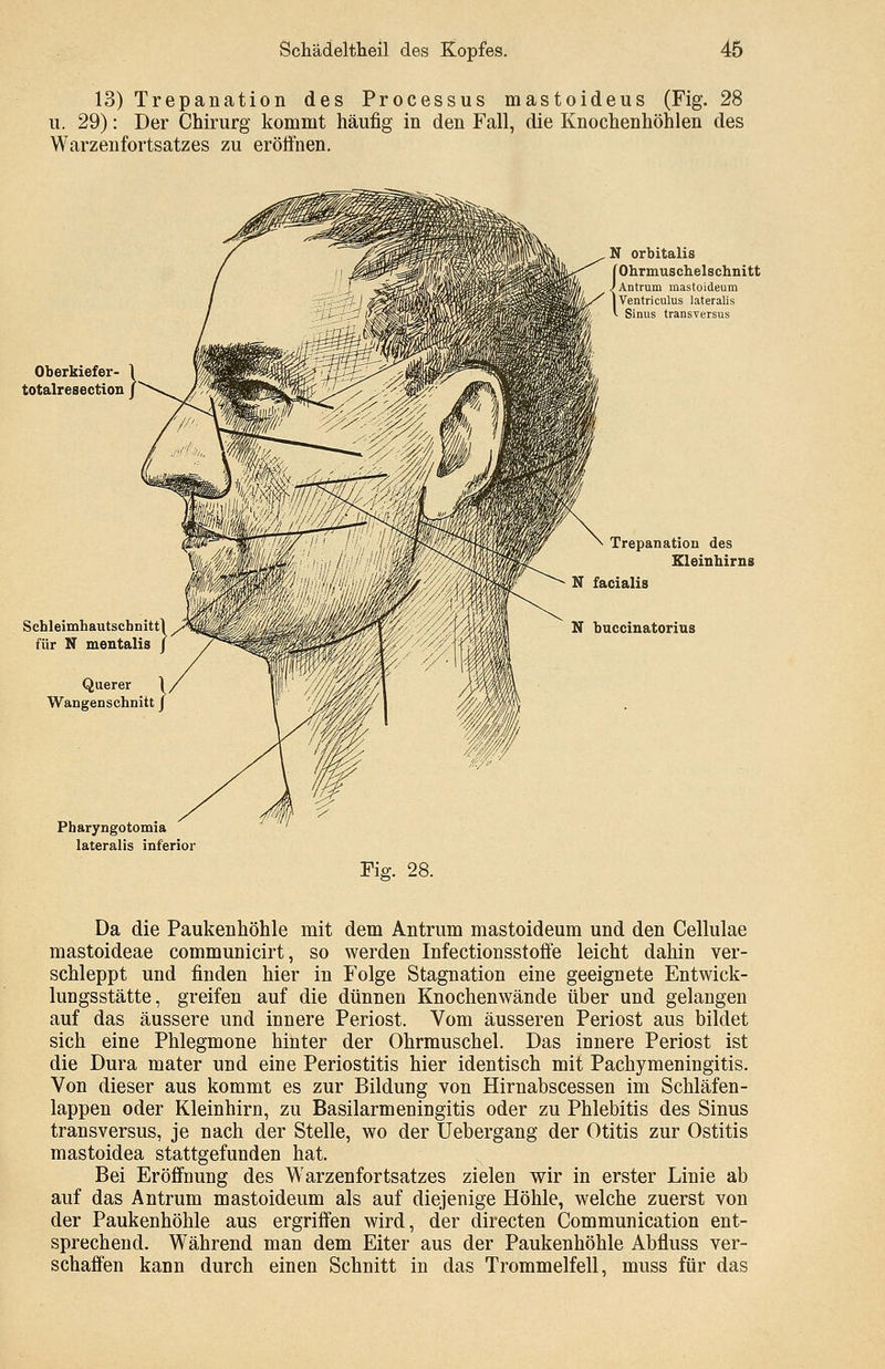 13) Trepanation des Processus mastoideus (Fig. 28 u. 29): Der Chirurg kommt häufig in den Fall, die Knochenhöhlen des Warzenfortsatzes zu eröffnen. Oberkiefer- totalresection Schleimhautschnitt] für N mentalis J Querer 1 Wangenschnitt J Pharyngotomia lateralis inferior N orbitalis { Ohrmuschelschnitt Antrum mastoideum Ventriculus lateralis Sirius transversus Trepanation des Kleinhirns N facialis N huccinatorius Fig. 28. Da die Paukenhöhle mit dem Antrum mastoideum und den Cellulae mastoideae communicirt, so werden Infectionsstoffe leicht dahin ver- schleppt und finden hier in Folge Stagnation eine geeignete Entwick- lungsstätte, greifen auf die dünnen Knochenwände über und gelangen auf das äussere und innere Periost. Vom äusseren Periost aus bildet sich eine Phlegmone hinter der Ohrmuschel. Das innere Periost ist die Dura mater und eine Periostitis hier identisch mit Pachymeningitis. Von dieser aus kommt es zur Bildung von Hirnabscessen im Schläfen- lappen oder Kleinhirn, zu Basilarmeningitis oder zu Phlebitis des Sinus transversus, je nach der Stelle, wo der Uebergang der Otitis zur Ostitis mastoidea stattgefunden hat. Bei Eröffnung des Warzenfortsatzes zielen wir in erster Linie ab auf das Antrum mastoideum als auf diejenige Höhle, welche zuerst von der Paukenhöhle aus ergriffen wird, der directen Communication ent- sprechend. Während man dem Eiter aus der Paukenhöhle Abfluss ver- schaffen kann durch einen Schnitt in das Trommelfell, muss für das