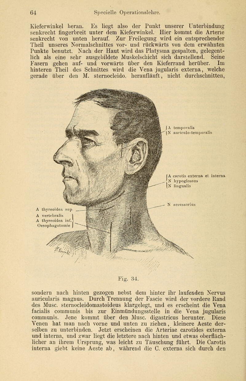 Kieferwinkel heran. Es liegt also der Punkt unserer Unterbindung senkrecht fingerbreit unter dem Kieferwinkel. Hier kommt die Arterie senkrecht von unten herauf. Zur Freilegung wird ein entsprechender Theil unseres Normalschnittes vor- und rückwärts von dem erwähnten Punkte benutzt. Nach der Haut wird das Platysma gespalten, gelegent- lich als eine sehr ausgebildete Muskelschicht sich darstellend. Seine Fasern gehen auf- und. vorwärts über den Kieferrand herüber. Im hinteren Theil des Schnittes wird die Vena jugularis externa, welche gerade über den M. sternocleido. heraufläuft, nicht durchschnitten, A thyreoidea A vertebralis A thyreoidea inf. Oesophagotomie JA temporalis |N auriculo-temporalis A carotis externa et interna .. hypoglossus |n lingualis N accessorius 34. sondern nach hinten gezogen nebst dem hinter ihr laufenden Nervus auricularis magnus. Durch Trennung der Fascie wird der vordere Rand des Muse, sternocleidomastoideus klargelegt, und es erscheint die Vena facialis communis bis zur Einmündungssteile in die Vena jugularis communis. Jene kommt über den Muse, digastricus herunter. Diese Venen hat man nach vorne und unten zu ziehen, kleinere Aeste der- selben zu unterbinden. Jetzt erscheinen die Arteriae carotides externa und interna, und zwar liegt die letztere nach hinten und etwas oberfläch- licher an ihrem Ursprung, was leicht zu Täuschung führt. Die Carotis interna giebt keine Aeste ab, während die C. externa sich durch den