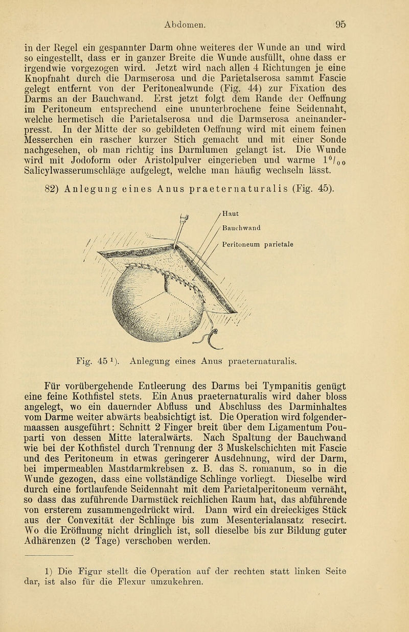 in der Regel ein gespannter Darm ohne weiteres der Wunde an und wird so eingestellt, dass er in ganzer Breite die Wunde ausfüllt, ohne dass er irgendwie vorgezogen wird. Jetzt wird nach allen 4 Richtungen je eine Knopfnaht durch die Darmserosa und die Parietalserosa sammt Fascie gelegt entfernt von der Peritonealwunde (Fig. 44) zur Fixation des Darms an der ßauchwand. Erst jetzt folgt dem Rande der Oeffhung im Peritoneum entsprechend eine ununterbrochene feine Seidennaht, welche hermetisch die Parietalserosa und die Darmserosa aneinander- presst. In der Mitte der so gebildeten Oeffhung wird mit einem feinen Messerchen ein rascher kurzer Stich gemacht und mit einer Sonde nachgesehen, ob man richtig ins Darmlumen gelangt ist. Die Wunde wird mit Jodoform oder Aristolpulver eingerieben und warme 1°/Oo Salicylwasserumschläge aufgelegt, welche man häufig wechseln lässt. 82) Anlegung eines Anus praeternaturalis (Fig. 45). Haut Bauchwand Peritoneum parietale Fig. 45 1). Anlegung eines Anus praeternaturalis. Für vorübergehende Entleerung des Darms bei Tympanitis genügt eine feine Kothfistel stets. Ein Anus praeternaturalis wird daher bloss angelegt, wo ein dauernder Abfluss und Abschluss des Darminhaltes vom Darme weiter abwärts beabsichtigt ist. Die Operation wird folgender- maassen ausgeführt: Schnitt 2 Finger breit über dem Ligamentum Pou- parti von dessen Mitte lateralwärts. Nach Spaltung der Bauchwand wie bei der Kothfistel durch Trennung der 3 Muskelschichten mit Fascie und des Peritoneum in etwas geringerer Ausdehnung, wird der Darm, bei impermeablen Mastdarmkrebsen z. B. das S. romanum, so in die Wunde gezogen, dass eine vollständige Schlinge vorliegt. Dieselbe wird durch eine fortlaufende Seidennaht mit dem Parietalperitoneum vernäht, so dass das zuführende Darmstück reichlichen Raum hat, das abführende von ersterem zusammengedrückt wird. Dann wird ein dreieckiges Stück aus der Convexität der Schlinge bis zum Mesenterialansatz resecirt. Wo die Eröffnung nicht dringlich ist, soll dieselbe bis zur Bildung guter Adhärenzen (2 Tage) verschoben werden. 1) Die Figur stellt die Operation auf der rechten statt linken Seite dar, ist also für die Flexur umzukehren.