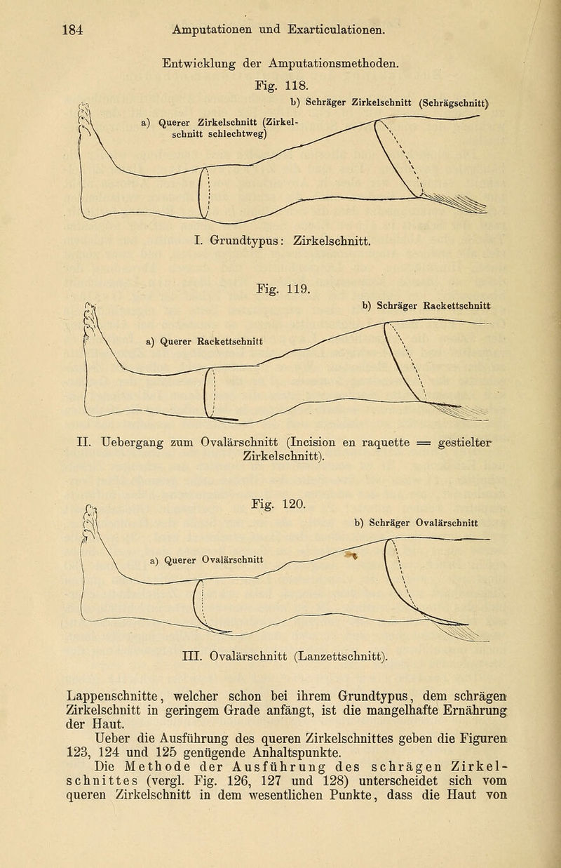 Entwicklung der Amputationsmethoden. Fig. 118. b) Schräger Zirkelschnitt (Schrägschnitt) I. Grundtypus: Zirkelschnitt. Fig. 119. b) Schräger Rackettschnitt II. Uebergang zum Ovalärschnitt (Incision en raquette = gestielter Zirkelschnitt). Fig. 120. b) Schräger Ovalärschnitt III. Ovalärschnitt (Lanzettschnitt). Lappenschnitte, welcher schon bei ihrem Grundtypus, dem schrägen Zirkelschnitt in geringem Grade anfängt, ist die mangelhafte Ernährung der Haut. Ueber die Ausführung des queren Zirkelschnittes geben die Figuren 123, 124 und 125 genügende Anhaltspunkte. Die Methode der Ausführung des schrägen Zirkel- schnittes (vergl. Fig. 126, 127 und 128) unterscheidet sich vom queren Zirkelschnitt in dem wesentlichen Punkte, dass die Haut von