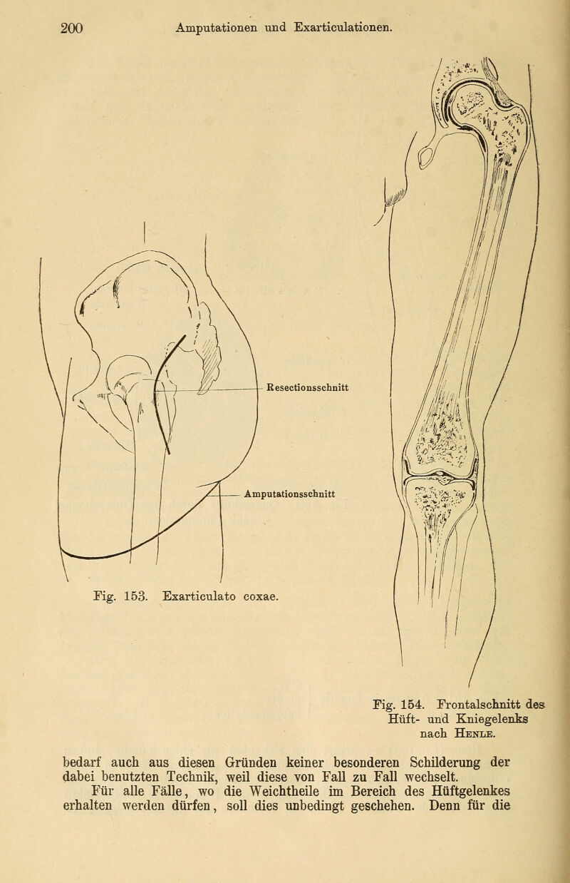 Resectionsschnitt Amputationsschnitt Fig. 153. Exarticulato coxae. Kg. 154. Frontalschnitt des Hüft- und Kniegelenks nach Henle. bedarf auch aus diesen Gründen keiner besonderen Schilderung der dabei benutzten Technik, weil diese von Fall zu Fall wechselt. Für alle Fälle, wo die Weichtheile im Bereich des Hüftgelenkes erhalten werden dürfen, soll dies unbedingt geschehen. Denn für die