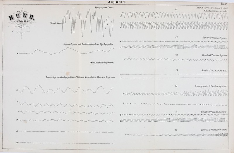 f! I^moarapkiam-Curoen. Mrmah Caroe. Saponiri'JnJedion nach Durchsdinddung brider Fago-Sympocthid. .mmmmmmmmw^' fl^ine künstlicht BespirationJ Saponiri'Jnjection ■fago-Sympaihid und Halsmark durchschnitten. Künstliche Respiraüoiv. jf, Ä-VvT' ZI n Z3 Z4^ Z5 Muskel-CuTüen,- fFrosckimterbrecherj M. GiLstrocnemiAts ('Tvormdki Derselbe 5^jmch äerJnjtdian.. V> Derselbe. lO''^nach der Jnjection/. Derselbe ß^n/ich derJnjedion. Triceps fcmoris IS^nachderJnfediony. Z6 Derselbe Zß ^nach derJnjecüoa. /•^/V^V/V-VV-v/VVVvrv^VVA/VVVAA/VXArvArVVVVVVVVV^^ *)WWM)VWMimN^\NMt»ilM^^tolMM^^ %7 DerselbeZ3 ^nach derJnjection/. ^^.^AMAAAMAArtA/\A^^^AA^A/^AAAAAA^AAAA/V•\AAA^A^AAArWWVV^^
