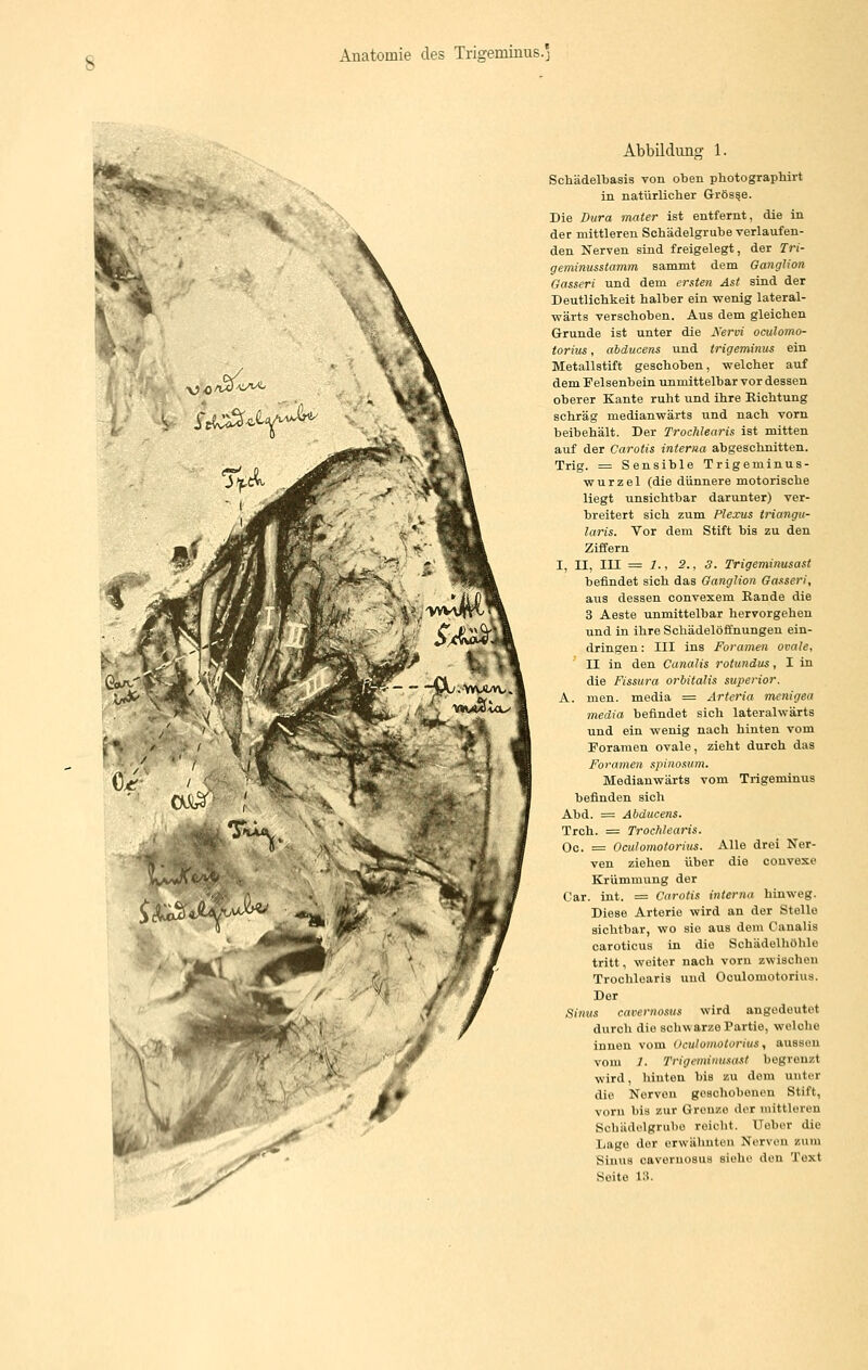 Abbildung 1. Schädelbasis von oben photographirt in natürlicher Grösse. Die Dura mater ist entfernt, die in der mittleren Schädelgrube verlaufen- den Nerven sind freigelegt, der Tri- geminusstamm sammt dem Ganglion Gasseri und dem ersten Ast sind der Deutlichkeit halber ein vcenig lateral- wärta verschoben. Aus dem gleichen Grunde ist unter die ^'ervi oculomo- torius, ahdvcens und trigeminus ein Metallstift geschoben, welcher auf dem Felsenbein unmittelbar vor dessen oberer Kante ruht und ihre Richtung schräg medianwärts und nach vorn beibehält. Der Trochlearis ist mitten auf der Carotis interna abgeschnitten. Trig. = Sensible Trigeminus- wurzel (die dünnere motorische liegt unsichtbar darunter) ver- breitert sich zum Plexus triangii- laris. Vor dem Stift bis zu den Ziffern I, II, III = 7., 2., 3. Trigeminusast befindet sich das Ganglion Gasseri, aus dessen convexem Rande die 3 Aeste unmittelbar hervorgehen und in ihre Schädelöffnungen ein- dringen : III ins Foramen ovale, II in den Canalis rolundus, I in die Fissura orhitalis superior. A. men. media = Arteria menigea media befindet sich lateralwärts und ein wenig nach hinten vom Foramen ovale, zieht durch das Foramen spinosum. Medianwärts vom Trigeminus befinden sich Abd. = Abducens. Trch. = Trochlearis. Oc. = Oculomotorius. Alle drei Ner- ven ziehen über die convexe Krümmung der Car. int. = Carotis interna hinweg. Diese Arterie wird an der Stelle sichtbar, wo sie aus dem Canalis caroticus in die Schädelhöhle tritt, weiter nach vorn zwischen Trochlearis und Oculomotorius. Der Simis cavernosus wird angedeutet durch die schwarze Partie, welche innen vom Oculomotorius, aussen vom 7. Trigeminusast begrenzt wird, hiuten bis zu dem unter die Nerven geacliobenou Stift, vorn bis zur Grouzo ilor mittleren Schädelgrube reicht. Uober die Lage der erwähnten Nerven zum Sinus cavernosus siehe den Text Seite 13.