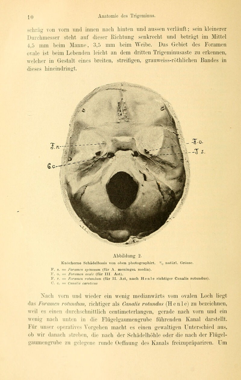schräg von vorn und innen nach hinten und aussen verläuft; sein kleinerer Durchmesser steht auf dieser Eichtung senkrecht und beträgt im Mittel 4,5 nmi beim Manne, 3,5 nun beim Weibe. Das Gebiet des Foramen ovale ist beim Lebenden leicht an dem dritten Trigeminusaste zu erkennen, welcher in Gestalt eines breiten, streifigen, gramveiss-röthlichen Bandes in dieses hineindringt. ---^«^■'^'fc^'AtiÄ-» ■ Abbildung 2. Knöcherne Schädelbasis von oben photograpliirt. 'j.j. uatürl. Grösse. F. 8. = Foramen spinosum (für A. meningea media). V. 0. = Foramen ovale (für III. Ast). F. r. = Foramen rotundum (für II. Ast, nach Ho nie richtiger Canalis rotundus). C. c. ^ Cannlis carotinus Nach vorn uud wieder ein wenig niediamvärts vom nvalou Locli liegt das Foramen rotundum, richtiger als Canalis rotundus (Heule) zu bezeichnen, weil CS einen durchschnittlich centimeterlangen, gerade nacli vtu'ii und ein wenig nach unten in die Flügelgaumengrube führenden Kanal darstellt. J''iir unser operatives Vorgehen maclit es einen gewaltigen ITiiterschied aus, ob wir danach stnOien, die n;icli der Scliädclbülilc oder die nach der Flügel- gaunicnL!Tnl)e zu gelegene i'imde (»ell'nnng des K'anals IVei/niJräpariren. Um