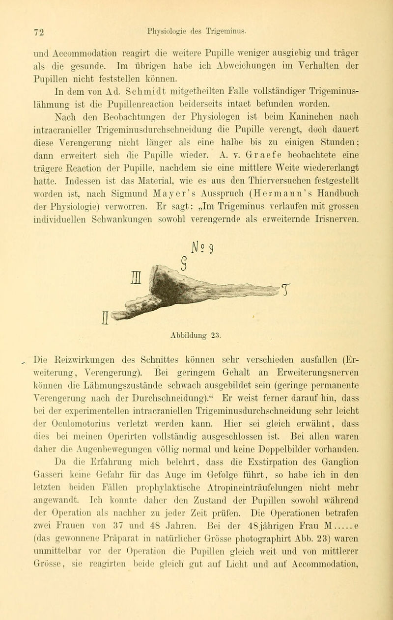 und Accommodation reagirt die weitere Pupille weniger ausgiebig und träger als die gesunde. Im übrigen habe ich Abweichungen im Verhalten der Pupillen nicht feststellen können. In dem von Ad. Schmidt mitgetheilten Falle vollständiger Tiigeminus- lähmung ist die Pupülenreaction beiderseits intact befimden worden. Nach den Beobachtungen der Physiologen ist beim Kaninchen nach intracranieller Trigeminusdurchschneidung die Pupille verengt, doch dauert diese Verengerung nicht länger als eine halbe bis zu einigen Stunden; dann erweitert sich die Pupille wieder. A. v. Graefe beobachtete eine trägere Reaction der Pupille, nachdem sie eine mittlere Weite wiedererlangt hatte. Indessen ist das Material, wie es aus den Thierversuchen festgestellt worden ist, nach Sigmund Maj'^er's Ausspruch (Hermann's Handbuch der Physiologie) verworren. Er sagt: „Im Trigeminus verlaufen mit grossen individuellen Schwankungen sowohl verengernde als erweiternde Irisnerven. Abbildung 23. Die ßeizwirkungen des Schnittes können sehr verschieden ausfallen (Er- weiterung, Verengerung). Bei geringem Gehalt an Erweiterungsnerven können die Lähmungszustände schwach ausgebildet sein (geringe permanente Verengerung nach der Durchschneidung). Er weist ferner darauf hin, dass bei der experimentellen intracraniellen Trigeminusdurchschneidung sehr leicht der Oculomotorius verletzt werden kann. Hier sei gleich erwähnt, dass dies bei meinen Operirten vollständig ausgeschlossen ist. Bei allen waren daher die Augenbewegungen völlig normal und keine Doppelbilder vorhanden. Da die Erfahrung mich belehrt, dass die Exstirpation des Ganglion Gasseri keine Gefahr für das Auge im Gefolge führt, so habe ich in den letzten beiden Fällen prophylaktische Atropininnträufelungi^n uiclit mehr angewandt. Ich konnte daher den Zustand der Pupillen sowohl während der Ojx'ration als nachher zu jeder Zeit prüfen. Die Operationen betrafen zwei Frauen von 'M und 48 Jiihreu. Bei der 48jährigen Frau M e (das gewonnene l*räparat in natürlicher Grösse photographirt Abb. 23) waren unmittelbai- vor der Operation die Pupillen gleich weit und von mittlerer Grösse, sie reagirlen lieide gleich' gut auf Licht und auf Accommodation,