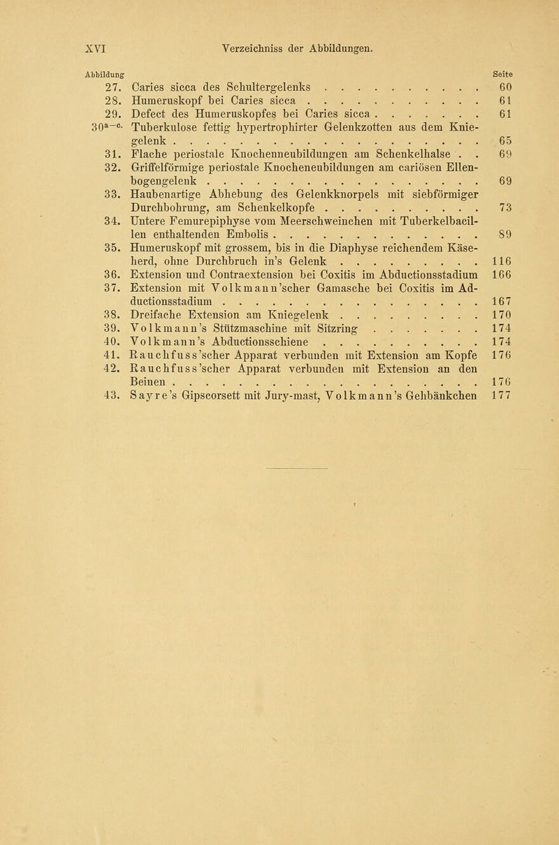 Abbildung Seite 27. Caries sicca des Schultergelenks 60 28. Humeruskopf bei Caries sicca 61 29. Defect des Humeruskopfes bei Caries sicca 61 30a-c. Tuberkulose fettig bypertrophirter Gelenkzotten aus dem Knie- gelenk 65 31. Flache periostale Knochenneubildungen am Schenkelhalse . . 69 32. Griffeiförmige periostale Knocheneubildungen am cariösen Ellen- bogengelenk 69 33. Haubenartige Abhebung des Gelenkknorpels mit siebförmiger Durchbohrung, am Schenkelkopfe 73 34. Untere Femurepiphyse vom Meerschweinchen mit Tuberkelbacil- len enthaltenden Embolis . 89 35. Humeruskopf mit grossem, bis in die Diaphyse reichendem Käse- herd, ohne Durchbruch in's Gelenk 116 36. Extension und Contraextension bei Coxitis im Abductionsstadium 166 37. Extension mit Volk mann'scher Gamasche bei Coxitis im Ad- ductionsstadium 167 38. Dreifache Extension am Kniegelenk 170 39. Volkmann's Stützmaschine mit Sitzring 174 40. Volk mann's Abductionsschiene 174 41. Rauchfuss'scher Apparat verbunden mit Extension am Kopfe 176 42. Rauchfuss'scher Apparat verbunden mit Extension an den Beinen . 176 43. Sayre's Gipscorsett mit Jury-mast, Volkmann's Gehbänkchen 177