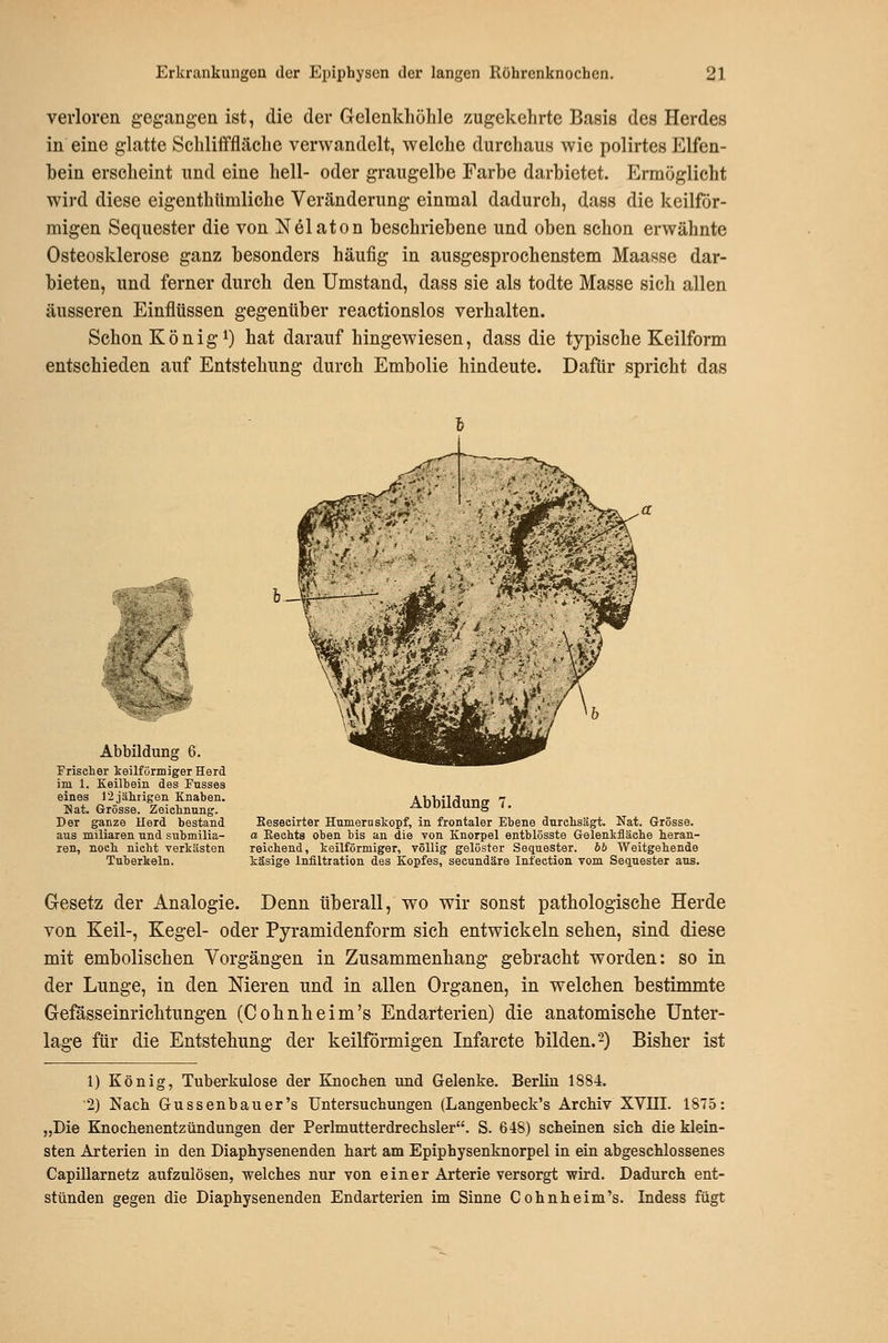 verloren gegangen ist, die der Gclenkhöhle zugekehrte Basis des Herdes in eine glatte Schlifffläche verwandelt, welche durchaus wie polirtes Elfen- bein erscheint und eine hell- oder graugelbe Farbe darbietet. Ermöglicht wird diese eigenthümliche Veränderung einmal dadurch, dass die keilför- migen Sequester die von Nelaton beschriebene und oben schon erwähnte Osteosklerose ganz besonders häufig in ausgesprochenstem Maasse dar- bieten, und ferner durch den Umstand, dass sie als todte Masse sich allen äusseren Einflüssen gegenüber reactionslos verhalten. Schon König 1) hat darauf hingewiesen, dass die typische Keilform entschieden auf Entstehung durch Embolie hindeute. Dafür spricht das Abbildung 6. Frischer ieilförmiger Herd im 1. KeiHein des Fusses eines 12jä]iiigeii Knaben. Hat. Grösse. Zeichnung. Der ganze Herd bestand aus miliaren nnd snbmilia- ren, noch nicht verkästen Tuberkeln. #'1 i^v- Abbildung 7. Eeseeirter Humern skopf, in frontaler Ebene durchsägt. Nat. Grösse. a Keehts oben bis an die von Knorpel entblösste Gelenkfläche heran- reichend, keilförmiger, völlig gelöster Sequester, bb Weitgehende käsige Infiltration des Kopfes, seeundäre Infection vom Sequester aus. Gesetz der Analogie. Denn tiberall, wo wir sonst pathologische Herde von Keil-, Kegel- oder Pyramidenform sich entwickeln sehen, sind diese mit embolischen Vorgängen in Zusammenhang gebracht worden: so in der Lunge, in den Nieren und in allen Organen, in welchen bestimmte Gefösseinrichtungen (Cohnheim's Endarterien) die anatomische Unter- lage für die Entstehung der keilförmigen Infarcte bilden. 2) Bisher ist 1) König, Tuberkulose der Knochen und Gelenke. Berlin 1884. 2) Nach Gussenbauer's Untersuchungen (Langenbeck's Archiv XVIII. 1875: „Die Knochenentzündungen der Perlmutterdrechsler. S. 648) scheinen sich die klein- sten Arterien in den Diaphysenenden hart am Epiphysenknorpel in ein abgeschlossenes Capillarnetz aufzulösen, welches nur von einer Arterie versorgt wird. Dadurch ent- stünden gegen die Diaphysenenden Endarterien im Sinne Cohnheim's. Indess fügt