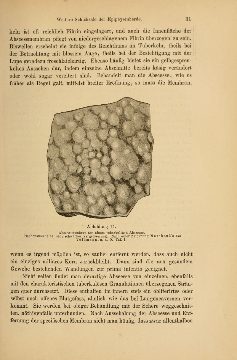 kein ist oft rciclilicli Fibrin eingelagert, und auch die Innenfläche der Abscessmembran pflegt von niedergeschlagenem Fibrin überzogen zu sein. Bisweilen erscheint sie infolge des Reichthums an Tuberkeln, theils bei der Betrachtung mit blossem Auge, theils bei der Besichtigung mit der Lupe geradezu froschlaichartig. Ebenso häufig bietet sie ein gelbgespren- keltes Aussehen dar, indem einzelne Abschnitte bereits käsig verändert oder wohl sogar vereitert sind. Behandelt man die Abscesse, wie es früher als Regel galt, mittelst breiter Eröffnung, so muss die Membran, Abbildung 14. Abscessmembran aas einem tuberkulösen Abscesse. Flächenansicbt bei sehr scbwacher Vergrösserung. Nacb einer Zeichnung Marehand's aus Volkmann, a. a. 0. Taf. I. wenn es irgend möglich ist, so sauber entfernt werden, dass auch nicht ein einziges miliares Korn zurückbleibt. Dann sind die aus gesundem Gewebe bestehenden Wandungen zur prima intentio geeignet. Nicht selten findet man derartige Abscesse von einzelnen, ebenfalls mit den charakteristischen tuberkulösen Granulationen überzogenen Strän- gen- quer durchsetzt. Diese enthalten im Innern stets ein obliterirtes oder selbst noch offenes Blutgefäss, ähnlich wie das bei Lungencavernen vor- kommt. Sie werden bei obiger Behandlung mit der Schere weggeschnit- ten, nöthigenfalls unterbunden. Nach Ausschabung der Abscesse und Ent- fernung der specifischen Membran sieht man häufig, dass zwar allenthalben