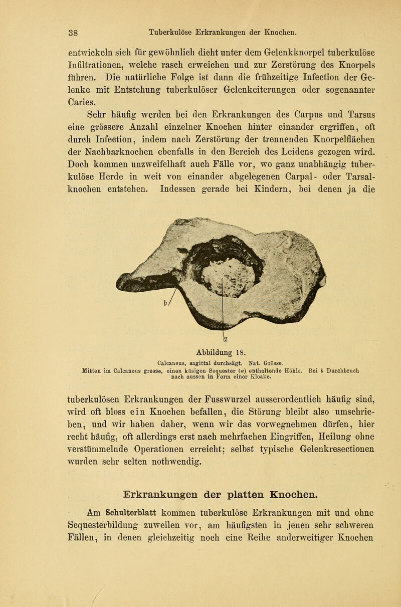 entwickeln sich für gewöhnlich dicht unter dem Gelenkknorpel tuberkulöse Infiltrationen, welche rasch erweichen und zur Zerstörung des Knorpels führen. Die natürliche Folge ist dann die frühzeitige Infection der Ge- lenke mit Entstehung tuberkulöser Gelenkeiterungen oder sogenannter Caries. Sehr häufig werden bei den Erkrankungen des Carpus und Tarsus eine grössere Anzahl einzelner Knochen hinter einander ergriffen, oft durch Infection, indem nach Zerstörung der trennenden Knorpelflächen der Nachbarknochen ebenfalls in den Bereich des Leidens gezogen wird. Doch kommen unzweifelhaft auch Fälle vor, wo ganz unabhängig tuber- kulöse Herde in weit von einander abgelegenen Carpal- oder Tarsal- knochen entstehen. Indessen gerade bei Kindern, bei denen ja die Abbildung 18. Calcaneus, sagittal durchsägt. Nat. Grösse. Mitten im Calcaneus grosse, einen käsigen Sequester (a) entlialtende Höhle. Bei 6 Durchbrueh nach aussen in Form einer Kloake. tuberkulösen Erkrankungen der Fusswurzel ausserordentlich häufig sind, wird oft bloss ein Knochen befallen, die Störung bleibt also umschrie- ben, und wir haben daher, wenn wir das vorwegnehmen dürfen, hier recht häufig, oft allerdings erst nach mehrfachen Eingriffen, Heilung ohne verstümmelnde Operationen erreicht; selbst typische Gelenkresectionen wurden sehr selten nothwendig. Erkrankungen der platten Knochen. Am Schulterblatt kommen tuberkulöse Erkrankungen mit und ohne Sequesterbildung zuweilen vor, am häufigsten in jenen sehr schweren Fällen, in denen gleichzeitig noch eine Eeihe anderweitiger Knochen