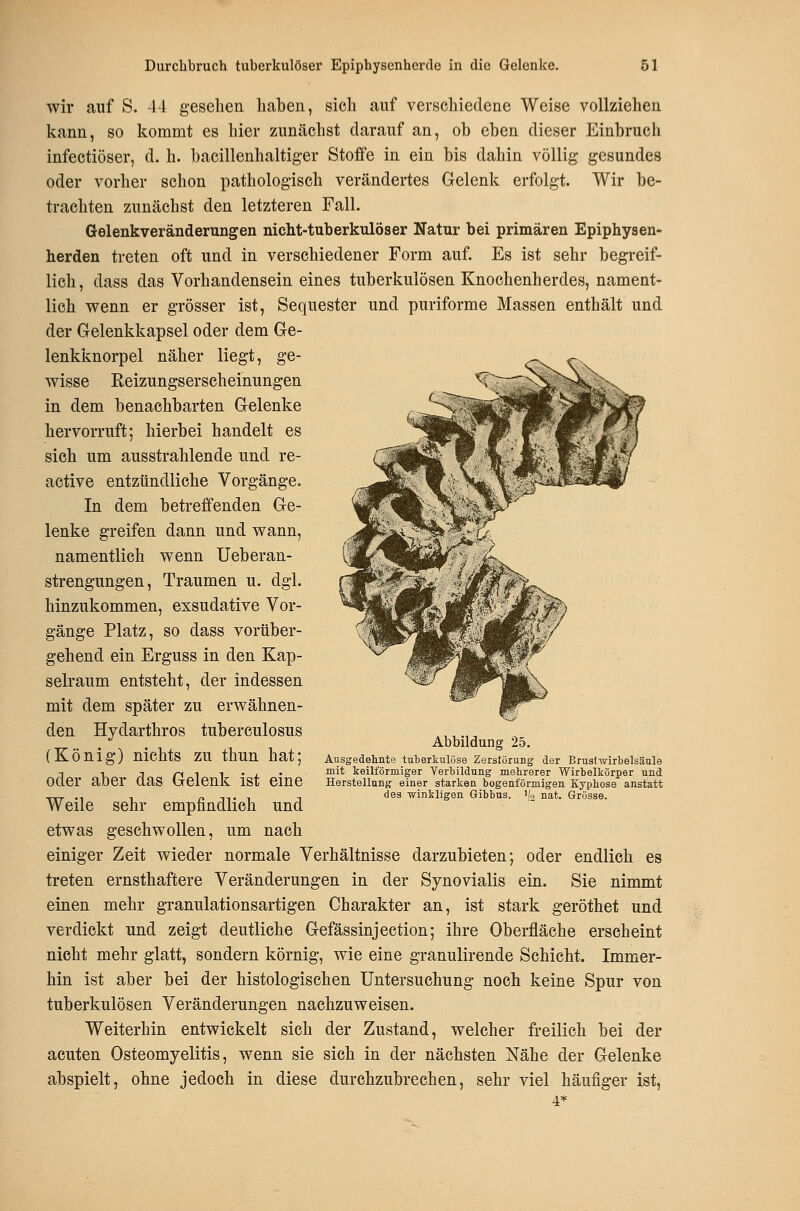 wir auf S. 44 gesehen liaben, sich auf verschiedene Weise vollziehen kann, so kommt es hier zunächst darauf an, ob eben dieser Einbruch infectiöser, d. h. bacillenhaltiger Stoffe in ein bis dahin völlig gesundes oder vorher schon pathologisch verändertes Gelenk erfolgt. Wir be- trachten zunächst den letzteren Fall. Gelenkveränderungen nicht-tuberkulöser Natur bei primären Epiphysen- herden treten oft und in verschiedener Form auf. Es ist sehr begreif- lich, dass das Vorhandensein eines tuberkulösen Knochenherdes, nament- lich v^enn er grösser ist, Sequester und puriforme Massen enthält und der Gelenkkapsel oder dem Ge- lenkknorpel näher liegt, ge- wisse Eeizungserscheinungen in dem benachbarten Gelenke hervorruft; hierbei handelt es sieh um ausstrahlende und re- active entzündliche Vorgänge. In dem betreffenden Ge- lenke greifen dann und wann, namentlich wenn Ueberan- strengungen, Traumen u. dgl. hinzukommen, exsudative Vor- gänge Platz, so dass vorüber- gehend ein Erguss in den Kap- selraum entsteht, der indessen mit dem später zu erwähnen- den Hydarthros tubereulosus (König) nichts zu thun hat; oder aber das Gelenk ist eine Weile sehr empfindlich und etwas geschwollen, um nach einiger Zeit wieder normale Verhältnisse darzubieten; oder endlich es treten ernsthaftere Veränderungen in der Synovialis ein. Sie nimmt einen mehr granulationsartigen Charakter an, ist stark geröthet und verdickt und zeigt deutliche Gefässinjection; ihre Oberfläche erscheint nicht mehr glatt, sondern körnig, wie eine granulirende Schicht. Immer- hin ist aber bei der histologischen Untersuchung noch keine Spur von tuberkulösen Veränderungen nachzuweisen. Weiterhin entwickelt sieh der Zustand, welcher freilich bei der acuten Osteomyelitis, wenn sie sich in der nächsten Nähe der Gelenke abspielt, ohne jedoch in diese durchzubrechen, sehr viel häufiger ist. Abbildung 25. Ausgedelinte tuberkulöse Zerstörung der Brustwirbelsäule mit teilförmiger Yerbildung mehrerer Wirbeltörper und Herstellung einer starken bogenförmigen Kyphose anstatt des winkligen Gibbus. '(o nat. Grösse.