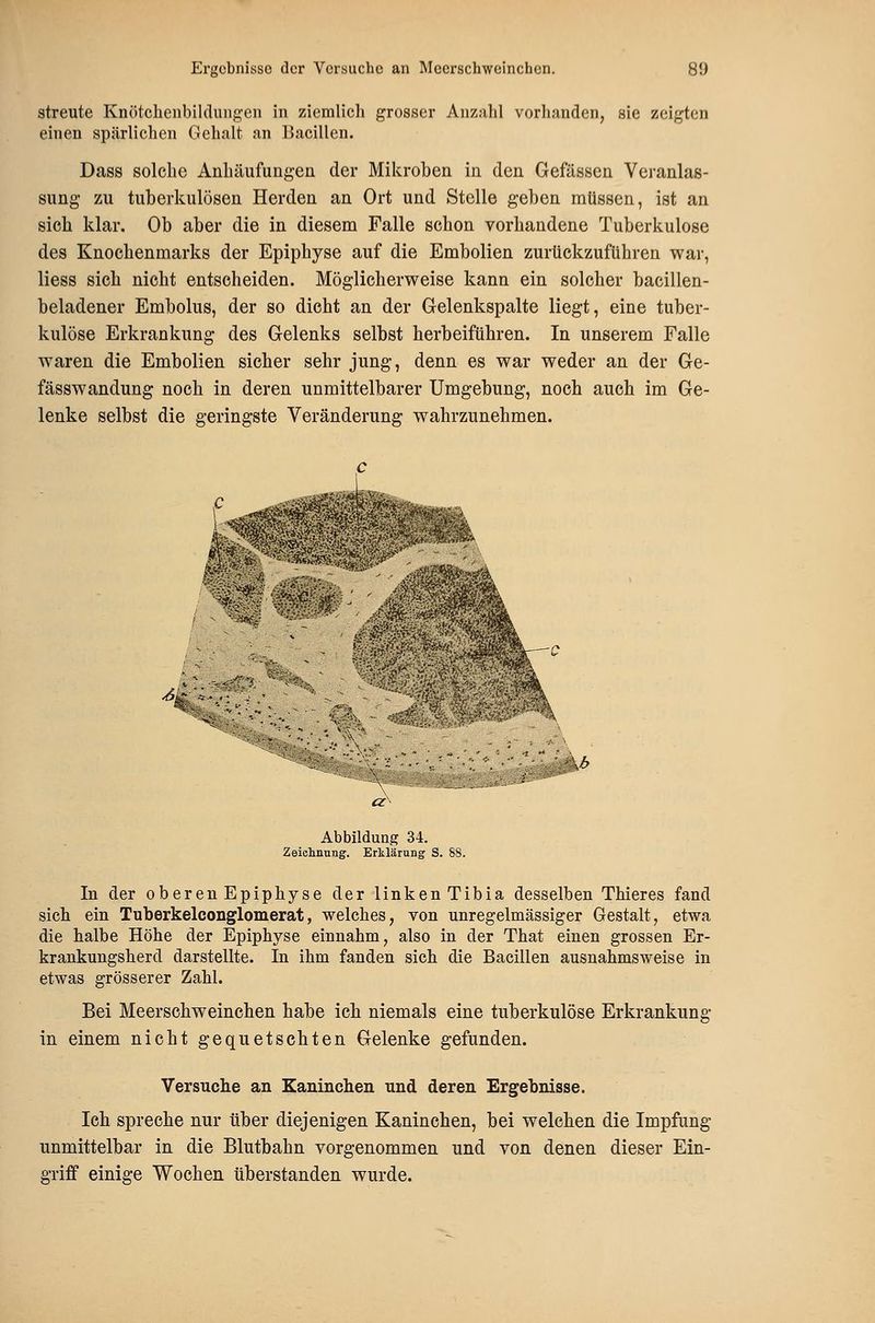 streute Knötclienbildung-en in ziemlich grosser Anzahl vorhanden, sie zeigten einen spärlichen Gehalt an Bacillen. Dass solche Anhäufungen der Mikroben in den Gefässen Veranlas- sung zu tuberkulösen Herden an Ort und Stelle geben müssen, ist an sich klar. Ob aber die in diesem Falle schon vorhandene Tuberkulose des Knochenmarks der Epiphyse auf die Embolien zurückzuführen M^ar, Hess sich nicht entscheiden. Möglicherweise kann ein solcher bacillen- beladener Embolus, der so dicht an der Gelenkspalte liegt, eine tuber- kulöse Erkrankung des Gelenks selbst herbeiführen. In unserem Falle waren die Embolien sicher sehr jung, denn es war weder an der Ge- fässwandung noch in deren unmittelbarer Umgebung, noch auch im Ge- lenke selbst die geringste Veränderung wahrzunehmen. A Abbildung 34. Zeielinung. Erklärung S. 88. In der oberen Epiphyse der linken Tibia desselben Thieres fand sich ein Tuberkelconglomerat, welches, von unregelmässiger Gestalt, etwa die halbe Höhe der Epiphyse einnahm, also in der That einen grossen Er- krankungsherd darstellte. In ihm fanden sich die Bacillen ausnahmsweise in etwas grösserer Zahl. Bei Meerschweinchen habe icb niemals eine tuberkulöse Erkrankung in einem nicht gequetschten Gelenke gefunden. Versuche an Kaninchen und deren Ergebnisse. Ich spreche nur über diejenigen Kaninchen, bei welchen die Impfung unmittelbar in die Blutbahn vorgenommen und von denen dieser Ein- griff einige Wochen überstanden wurde.