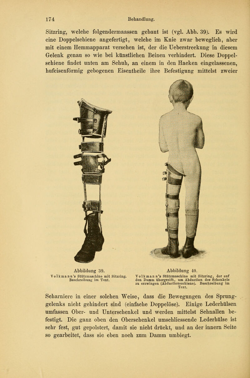 Sitzring, welche folgendermaassen gebaut ist (vgl. Abb. 39). Es wird eine Doppelschiene angefertigt, welche im Knie zwar beweglich, aber mit einem Hemmapparat versehen ist, der die Ueberstreckung in diesem Gelenk genau so wie bei künstlichen Beinen verhindert. Diese Doppel- schiene findet unten am Schuh, an einem in den Hacken eingelassenen, hufeisenförmig gebogenen Eisentheile ihre Befestigung mittelst zweier Abbildung 39. Volkmann's StützmascMne mit Sitzring. Beschreibung im Text. Abbildung 40. Volk man n's StützmascMne mit Sitzring, derauf den Damm übergreift, um Abduction des Sehenkels zu erzwingen (Abduetionsschiene). Beschreibung im Text. Scharniere in einer solchen Weise, dass die Bewegungen des Sprung- gelenks nicht gehindert sind (einfache Doppelöse). Einige Lederhülsen umfassen Ober- und Unterschenkel und werden mittelst Schnallen be- festigt. Die ganz oben den Oberschenkel umschliessende Lederhülse ist sehr fest, gut gepolstert, damit sie nicht drückt, und an der Innern Seite so gearbeitet, dass sie eben noch zum Damm umbiegt.