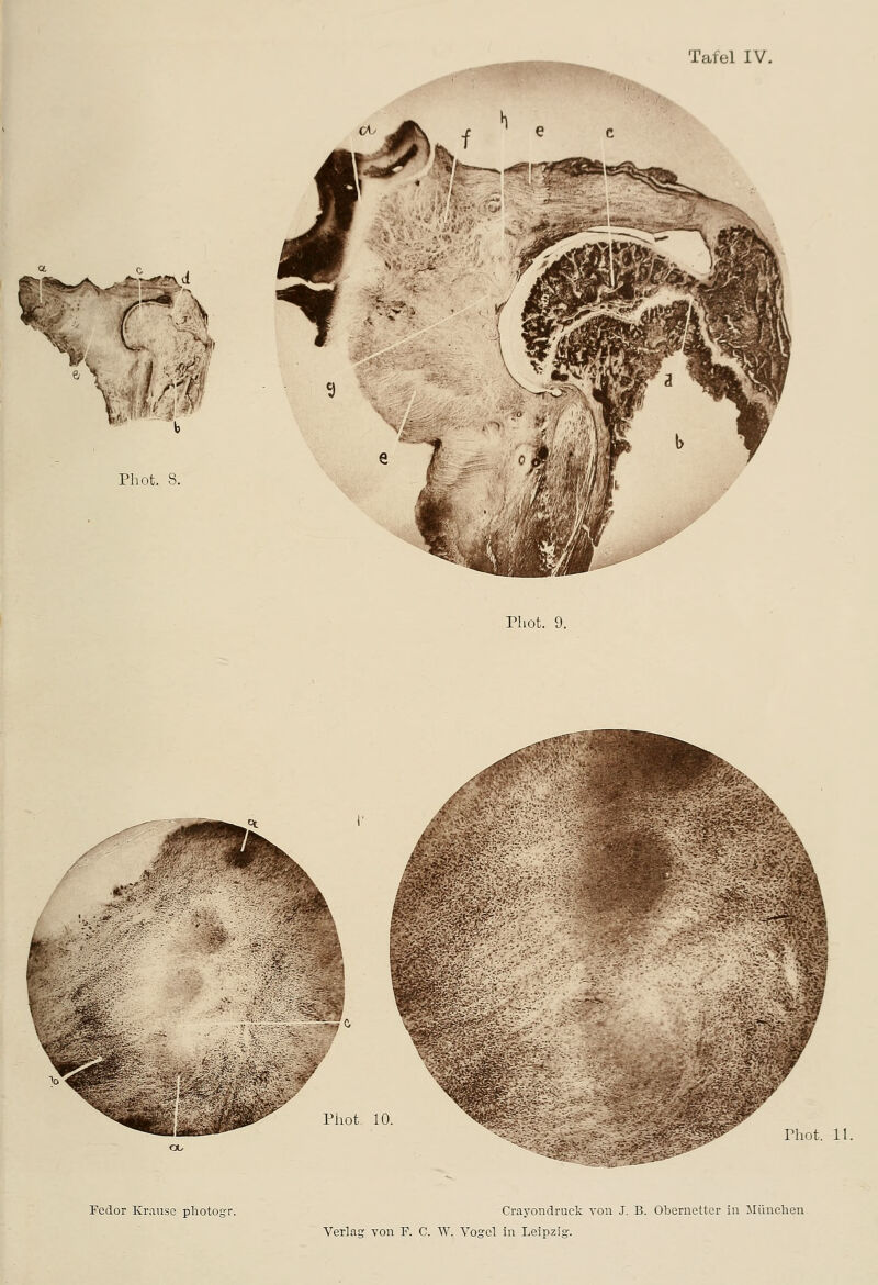 'V'- a -' b Phot. 8. Phot. 9. Pliot. 10 Phot. 11. Fedor Krause photogr. Crayondruck von J. B. Obernetter in Müiiclieii-