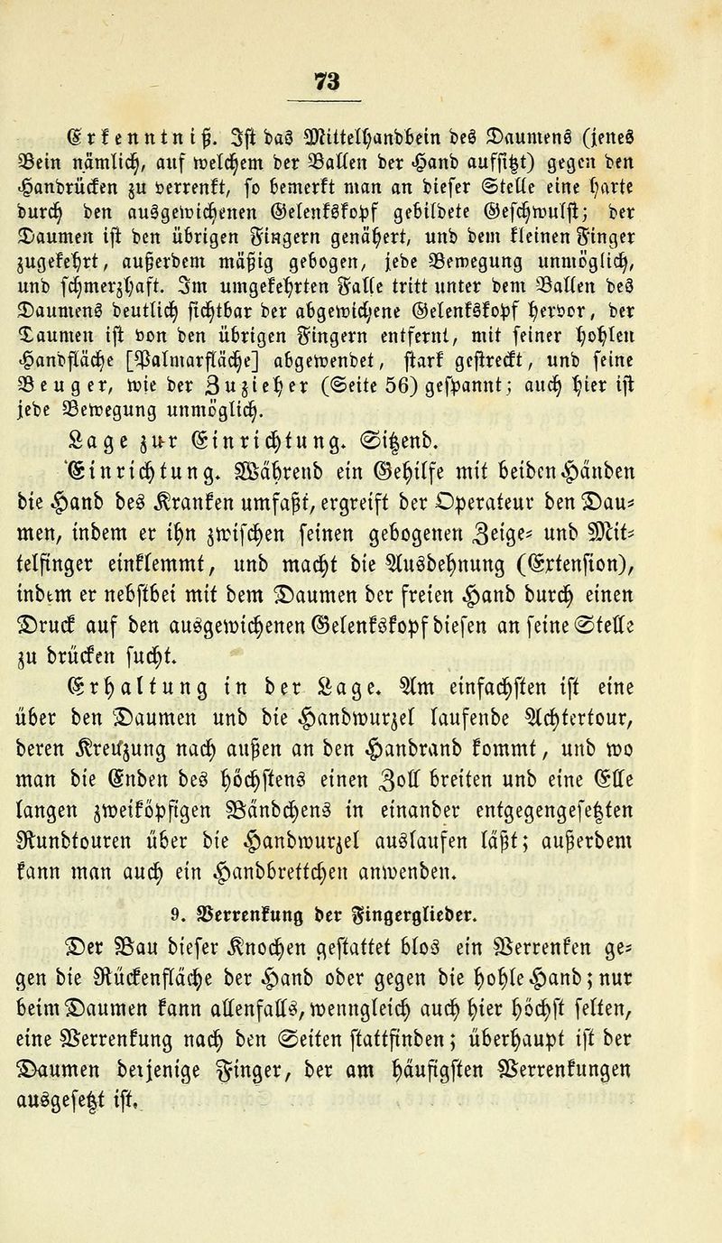 (g r ! e n n t n i ß. 5ft baS 9ÄitteU)attb6em beö 3)aumen6 (jeneS 33ein nämlid^, auf trelc^em ber SSalXcn ber «§anb auffi|t) gegen ben ^anbrücfen §u öerrenft, fo 6emer!t man an biefer StcKc eine (;arte burd^ ben auägelrtc^enen ©elenföfo^f gebilbete ©efc^tüuljl; ber Daumen ij^ ben übrigen i^ingern genähert, unb beut ileinen Sringer jugefe'^rt, au^erbem mäßig gebogen/ iebc aSemegung unmöglich, unb fd)merjt;aft. 5m umgekehrten ^a((c tritt unter bem 33aUen bcS ^aumeng beutUc^ fic^tbar ber abgen)id;erte (^dtnUto^pf ^eröor, ber Daumen ifi bon ben übrigen i^ingern entfernt, mit feiner l)o^ten ^anbfiäc^e [^atmarftäc^e] abgetvenbet, ftarf gefiretft, unb feine aSeuger, ivic ber 3ujie^er («Seite 56) gef)3annt; auc^ t;ier ift iebc aSetregung unmöglich. Sage ^u-r (Stnrtd^tung* @i|enb. 'Einrichtung* Sß^äkeub ein ©e^ilfe mit beibcnRauben bk cf)attb be§ ^ranfen umfaßt, ergreift ber Oiperateur ben ^au^^ mett, inbem er i^n jtrifd^en feinen gebogenen S^i^^- wnb ^liU telftnger einfremmt, unb mac^t hk ^(u^be^nung (Ertenfion), inbtm er neBftbei mit bem Daumen ber freien .g)anb bur^ einen ^rud auf ben au^genjid^enen^etenföfopfbiefen an feine stelle ju bxMtn fud^t. Ermattung in ber Sage* ^m einfad^ften ift eine über ben 'Daumen unb bie^g)anbn)ur^et laufenbe ^c^tcrtour, beren i^retfjung nad^ au^en an ben ^anbranb fommt, unb tt>o man bk @nben be§ ^öc^ften^ einen !^oU breiten unb eine ^Kt (angen ^weiföpftgen sßdnbc^en§ in einanber entgegengefe|ten fJlunbtonren über hk §anbmurjel auslaufen U^t; au^erbem fann man aud) ein ^anbbrettc^en ann)enben* 9. SSerrenfung ber ^ingerglieber. ©er ?Bau biefer ^noc^en geftattet bIo3 ein S^errenfen ge^ gen bk Slütfenfldc^e ber $anb ober gegen hk ^o^(e$anb;nur beim Daumen fann allenfalls, tpenngleic^ auc^ ^ier ^öc^ft fetten, eine SSerrenfung nad^ ben (Seiten ftattftnben; überhaupt ift ber ^umen bei jenige Ringer, ber am ^duftgften SS^errenfungen auSgefe|t ift,