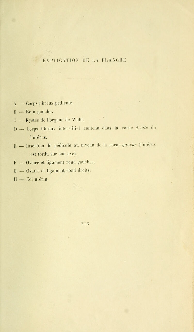 EXPLICATION DE LA PLANCHE A — Corps fibreux pédicule. H — Rein gauche. C — Kystes de l'organe de Wolff. D _ Corps fibreux interstitiel contenu dans la corne droite de l'utérus. Ë _ Insertion du pédicule au niveau de la corne gauche (l'utérus est tordu sur son axe). Y — Ovaire et ligament rond gauches. G — Ovaire et ligament rond droits. II — Col utérin. FIN