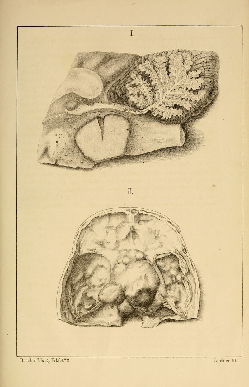 Druck v.J.Jung. Frl<fr(-.aM. Locliou- iith.