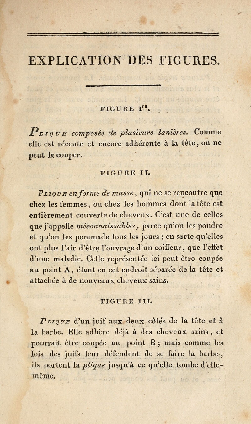 EXPLICATION DES FIGURES. » FIGURE 1 . Jruqun composée de plusieurs lanières. Comme elle est récente et encore adhérente à la tête, on ne peut la couper. FIGURE II. PziQVF. en forme de masse ^ qni ne se rencontre que chez les femmes, ou chez les hommes dontlalête est entièrement couverte de cheveux. C'est une de celles que j'appelle méconnaissables, parce qu'on les poudre et qu'on les pommade tous les jours ; en sorte qu'elles ont plus l'air d'être l'ouvrage d'un coiffeur, que l'effet d'une maladie. Celle représentée ici peut être coupée au point A, étant en cet endroit séparée de la tête et attachée à de nouveaux cheveux sains. FIGURE III. Pli QUE d'un juif aux deux côtés de la tête et à la barbe. Elle adhère déjà à des cheveux sains, et pourrait être coupée au point B ; mais comme les lois des juifs leur défendent de se faire la barbe, ils portent \^ plique jusqu'à ce qu'elle tombe d'elle- même.
