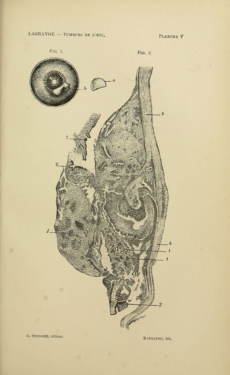 Fig. i. Fig. 2. G. Steixiieil, éditeur. IvARJtAXSKT. ciel.