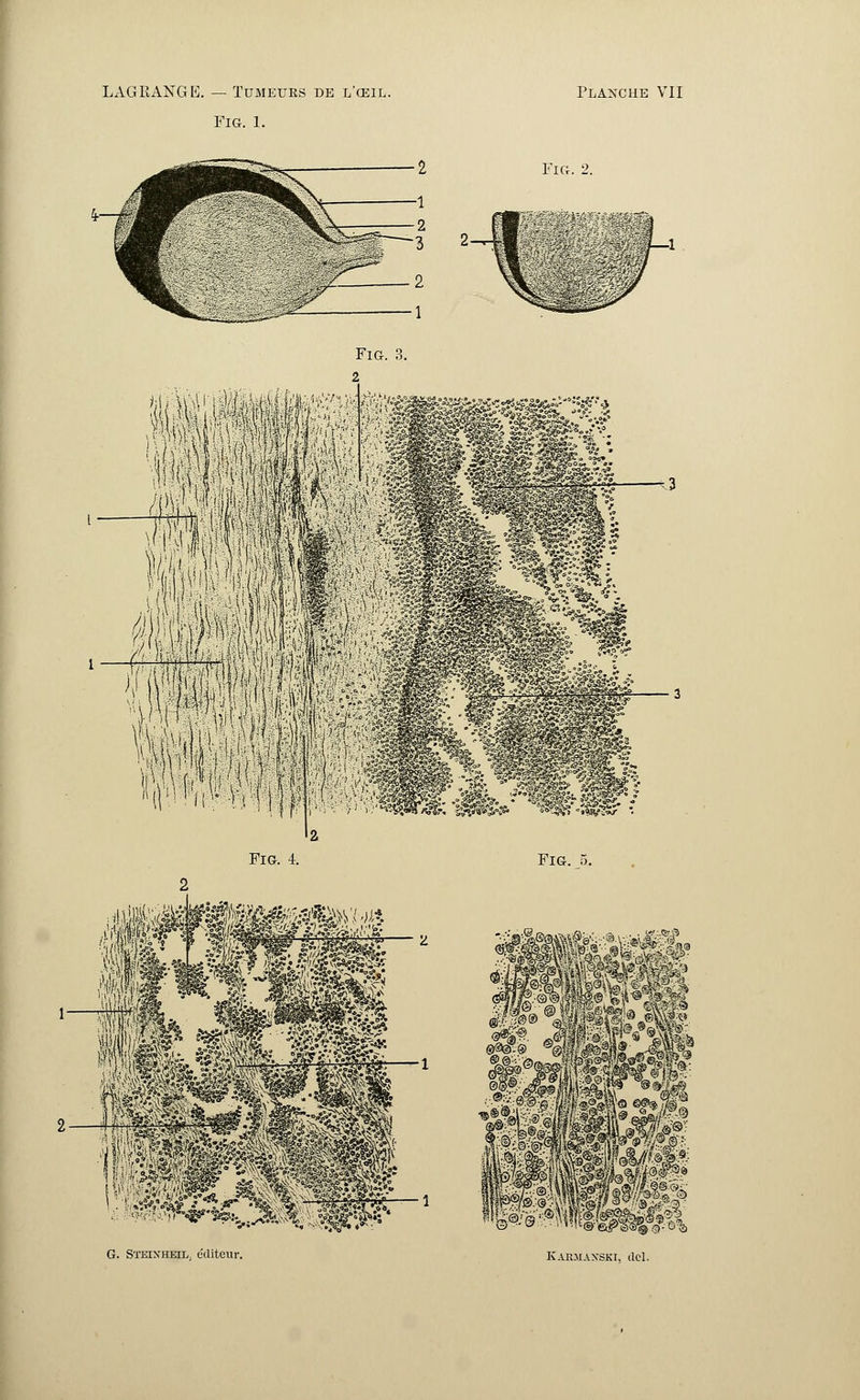 Fig. 1. Fig. 2. Fig. 3.