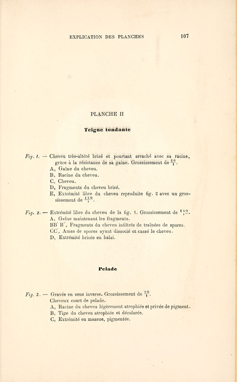 PLANCHE II Teigàe tondante Fi[i. i. — Cheveu très-altéré brisé et pourtant arraché avec sa racine, grâce à la résistance de sa gaine. Grossissement de-^. A, Gaîne du cheveu. B, Racine du cheveu. C, Cheveu. D, Fragments du cheveu brisé. E, Extrémité libre du cheveu reproduite fig. 2 avec un gros- sissement de —[-. Fig. 2. — Extrémité libre du cheveu de la fig. 1. Grossissement de ^,-. A, Gaîne maintenant les fragments. BB' B', Fragments du cheveu infiltrés de traînées de spores. CC'^ Amas de spores ayant dissocié et cassé le cheveu. D, Extrémité brisée en balai. Pelade Fij. 3. — Gravée en sens inverse. Grossissement de \. Cheveux court de pelade. A, Racine du cheveu légèrement atrophiée et privée de pigment. B, Tige du cheveu atrophiée et décolorée. C, Extrémité en massue, pigmentée.