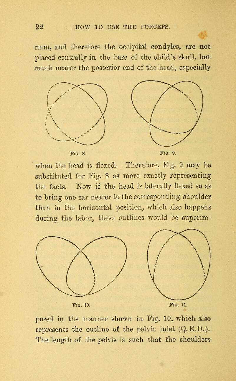 num, and tlierefore the occipital condyles, are not placed centrally in the base of the child's skull, but much nearer the posterior end of the head, especially Fig. 8. Fig. 9. when the head is flexed. Therefore, Fig. 9 may be substituted for Fig. 8 as more exactly representing the facts. Now if the head is laterally flexed so as to bring one ear nearer to the corresponding shoulder than in the horizontal position, which also happens during the labor, these outlines would be superim- FiG. 10. Fig. 11. posed in the manner shown in Fig. 10, which also represents the outline of the pelvic inlet (Q.E.D.). The length of the pelvis is such that the shoulders