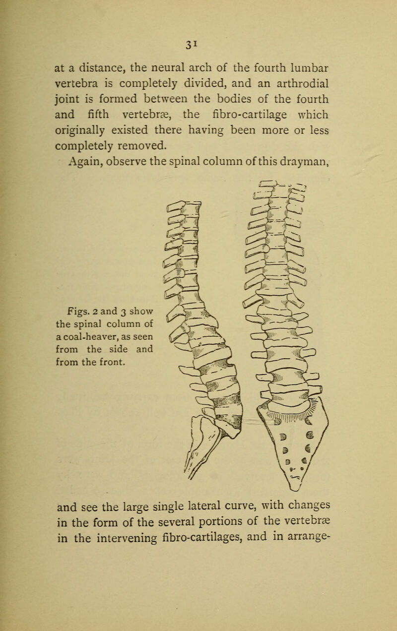 at a distance, the neural arch of the fourth lumbar vertebra is completely divided, and an arthrodial joint is formed between the bodies of the fourth and fifth vertebrae, the fibro-cartilage which originally existed there having been more or less completely removed. Again, observe the spinal column of this drayman, Figs. 2 and 3 show the spinal column of a coal-heaver, as seen from the side and from the front. and see the large single lateral curve, with changes in the form of the several portions of the vertebra in the intervening fibro-cartilages, and in arrange-