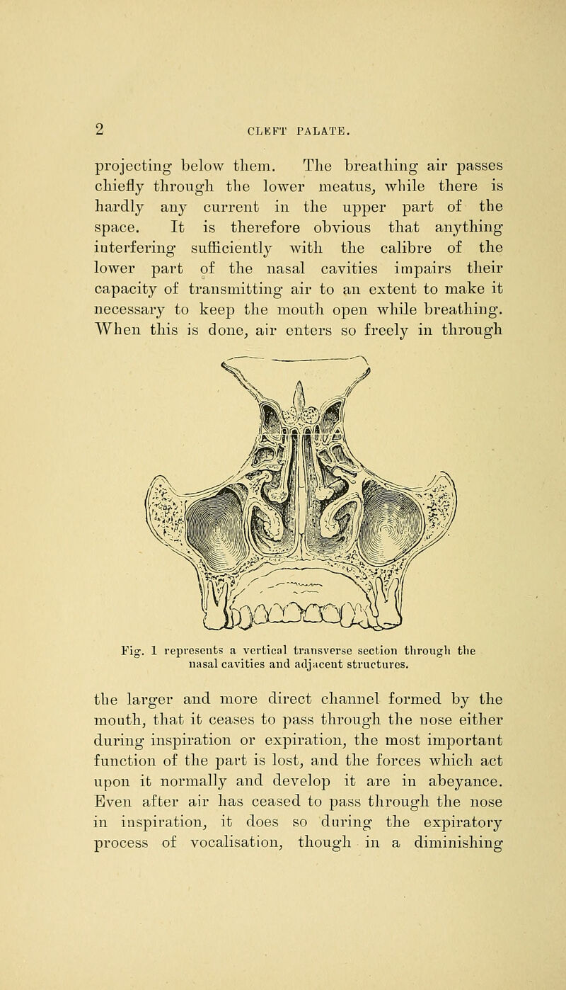 projecting below tliem. The breathing air passes chiefly through the lower meatus^ while there is hardly any current in the upper part of the space. It is therefore obvious that anything interfering sufficiently with the calibre of the lower part of the nasal cavities impairs their capacity of transmitting air to an extent to make it necessary to keep the mouth open while breathing. When this is done^ air enters so freely in through Fig. 1 represents a vertical transverse section through the nasal cavities and adjacent structures. the larger and more direct channel formed by the mouth, that it ceases to pass through the nose either during inspiration or expiration, the most important function of the part is lost^ and the forces which act upon it normally and develop it are in abeyance. Even after air has ceased to pass through the nose in inspiration^ it does so during the expiratory process of vocalisation, though in a diminishing