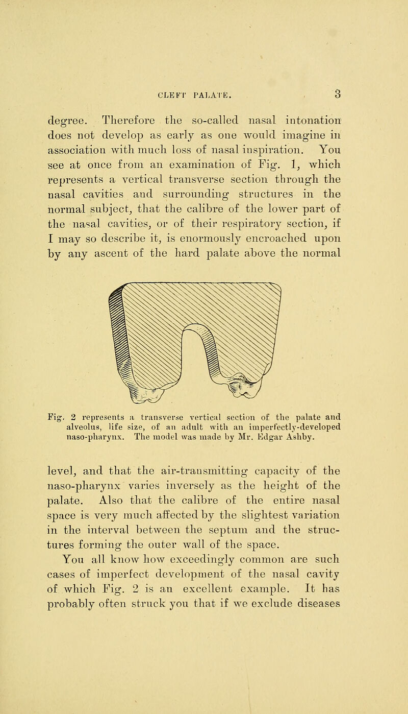 degree. Therefore the so-called nasal intonation does not develop as early as one would imagine in association with much loss of nasal inspiration. You see at once from an examination of Fig. 1, which represents a vertical transverse section through the nasal cavities and surrounding structures in the normal subject^ that the calibre of the lower part of the nasal cavities^ or of their respiratory section^ if I may so describe it, is enormously encroached upon by any ascent of the hard palate above the normal Fig. 2 represents a transverse vertical section of the palate and alveolus, life size, of an adult with an imperfectly-developed naso-pharynx. The model was made by Mr. Edgar Ashby. level, and that the air-transmitting capacity of the naso-pharynx varies inversely as the height of the palate. Also that the calibre of the entire nasal space is very much affected by the slightest variation in the interval between the septum and the struc- tures forming the outer wall of the space. You all know how exceedingly common are such cases of imperfect development of the nasal cavity of which Fig. 2 is an excellent example. It has probably often struck you that if we exclude diseases