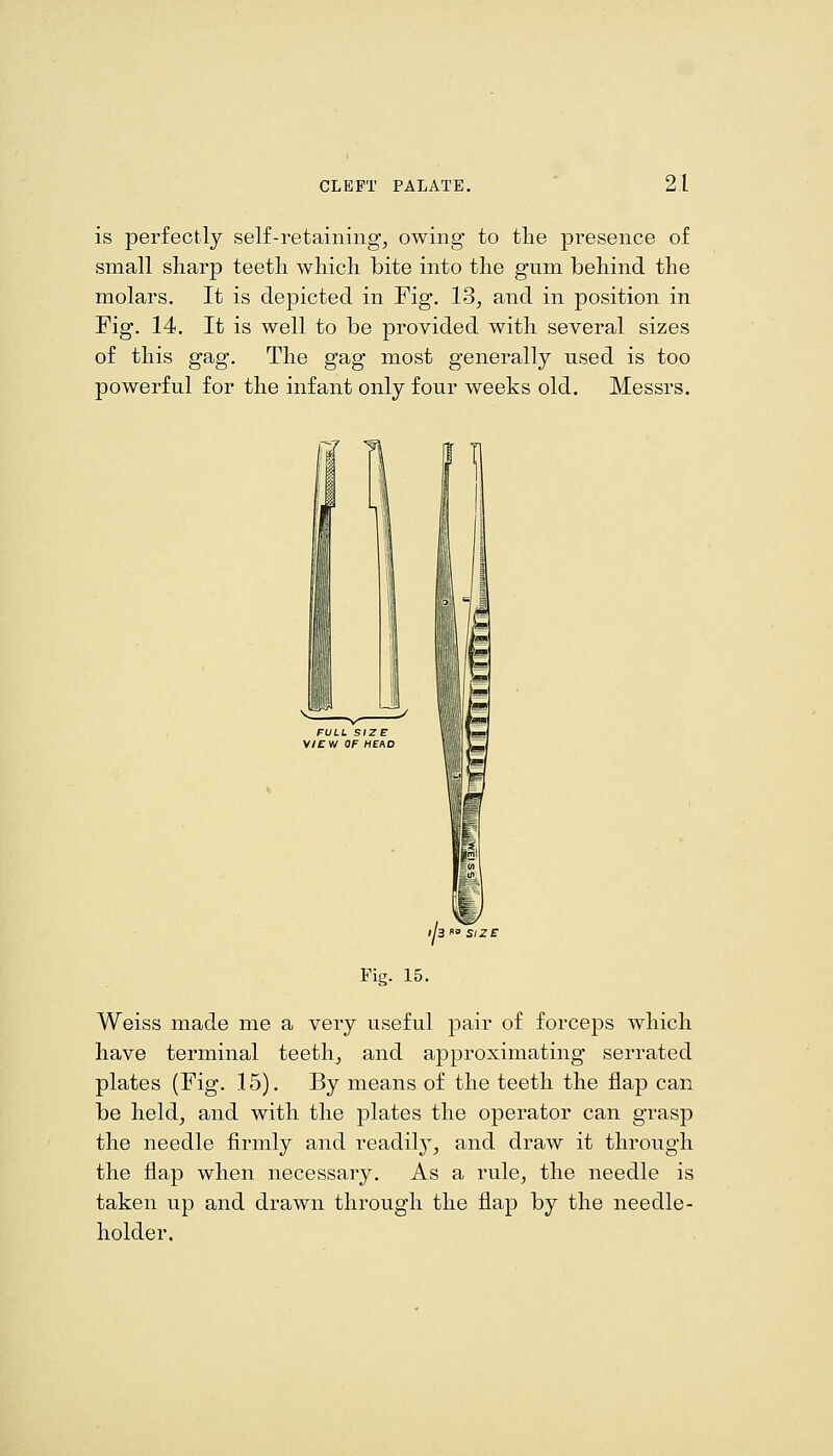 is perfectly self-retaining, owing to tlie presence of small sharp teeth which bite into the gnm behind the molars. It is depicted in Fig, 13, and in position in Fig. 14, It is well to be provided with several sizes of this gag. The gag most generally used is too powerful for the infant only four weeks old. Messrs. I a' SI2E Fig. 15. Weiss made me a very useful pair of forceps which have terminal teeth, and approximating serrated plates (Fig. 15). By means of the teeth the flap can be held, and with the plates the operator can grasp the needle firmly and readily, and draw it through the flap when necessary. As a rule, the needle is taken up and drawn through the flap by the needle- holder.