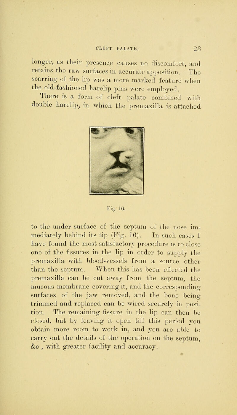 longer, as their ^jresence causes no discomfort, and retains the raw surfaces in accurate apposition. The scarring of the lip was a more marked feature when the old-fashioned harelip pins were employed. There is a form of cleft palate combined with double harelip, in which the premaxilla is attached Fi-. 16. to the under surface of the septum of the nose im- mediately behind its tip (Fig. 16). In such cases I have found the most satisfactory procedure is to close one of the fissures in the lip in order to supply the premaxilla with blood-vessels from a source otlier than the septum. When this has been effected the premaxilla can be cut away from the septum, the mucous membrane covering it, and the corresponding surfaces of the jaw removed, and the boue being- trimmed and replaced can be wired securely in posi- tion. The remaining fissure in the lip can then be closed, but by leaving it open till this period you obtain more room to work in, and you are able to carry out the details of the operation on the septum, &c , with greater facility and accuracy.