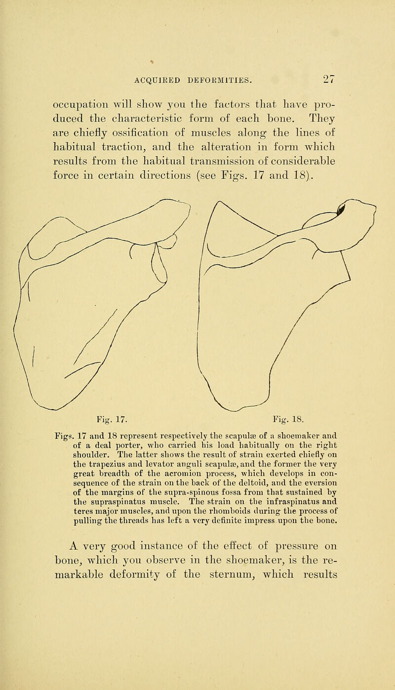 occupation will show you the factors that have pro- duced the characteristic form of each bone. They are chiefly ossification of muscles along the lines of habitual traction, and the alteration in form which results from the habitual transmission of considerable force in certain directions (see Figs. 17 and 18). Figs. 17 and 18 represent respectively the scapulae of a shoemaker and of a deal porter, who carried his load habitually on the right shoulder. The latter shows the result of strain exerted chiefly on the trapezius and levator anguli scapulae, and the former the very great breadth of the acromion process, which develops in con- sequence of the strain on the back of the deltoid, and the eversion of the margins of the supra-spinous fossa from that sustained by the supraspinatus muscle. The strain on the infraspinatus and teres major muscles, and upon the rhomboids during the process of pulling the threads has left a very definite impress upon the bone. A very good instance of the effect of pressure on bone, which you observe in the shoemaker, is the re- markable deformity of the sternum, which results