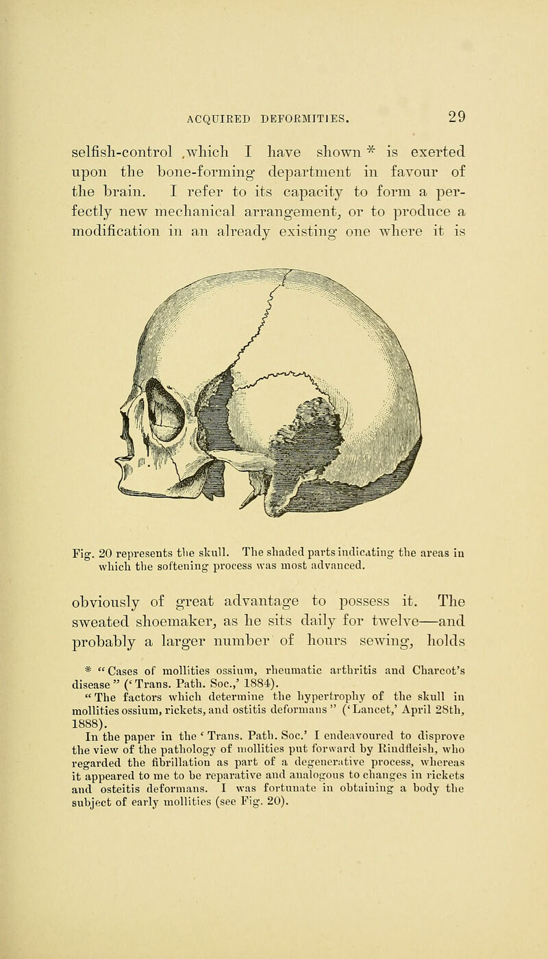 selfisli-control .wliicli I have sliown ^ is exerted upon the bone-forming department in favour of the brain. I refer to its capacity to form a per- fectly new mechanical arrangement^ or to produce a modification in an already existing one where it is Fig. 20 represents tlie skull. The shaded parts indicating the areas iu which the softening process was most advanced. obviously of great advantage to possess it. The sweated shoemaker, as he sits daily for twelve—and probably a larger number of hours sewing, holds *  Cases of moUities ossium, rheumatic arthritis and Charcot's disease ('Trans. Path. Soc.,' 1884).  The factors which determine the hypertrophy of the skull in mollitiesossium,rickets,and ostitis deformans ('Lancet,' April 28th, In the paper in the ' Trans. Path. Soc' I endeavoured to disprove the view of the pathology of mollities put forward by Rindtleish, who regarded the fibrillation as part of a degenerative process, whereas it appeared to me to be reparative and analogous to changes in rickets and osteitis deformans. I was fortunate in obtaining a body the subject of early mollities (see Fig. 20).