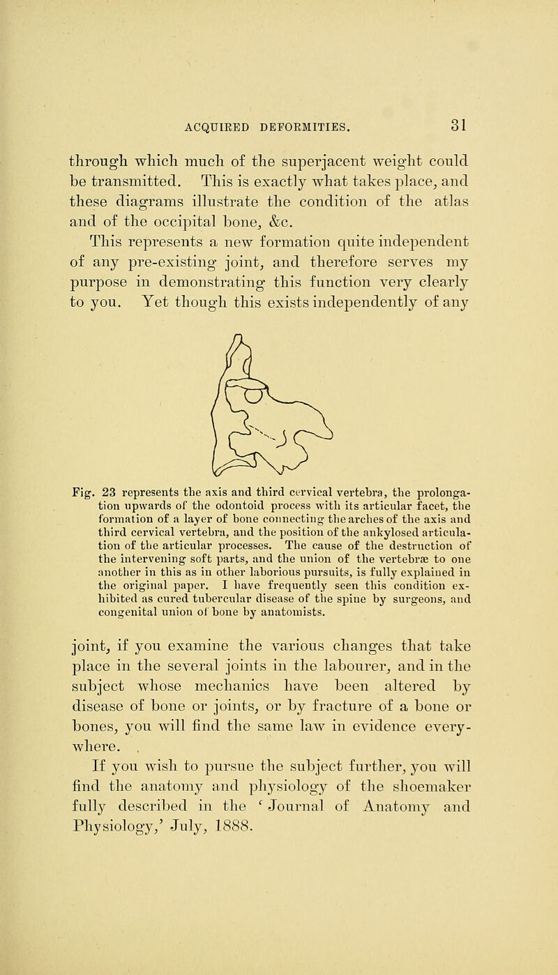 througli wliicli mucli of the superjacent weight could be transmitted. This is exactly what takes place^ and these diagrams illustrate the condition of the atlas and of the occipital bonOj &c. This represents a new formation quite independent of any pre-existing joint^ and therefore serves my purpose in demonstrating this function very clearly to you. Yet though this exists independently of any Fig. 23 represents the axis and third cervical vertebra, the prolonga- tion upwards of the odontoid process with its articular facet, the formation of a layer of bone connecting the arches of the axis and third cervical vertebra, and the position of the ankylosed articula- tion of the articular processes. The cause of the destruction of the intervening soft parts, and the union of the vertebrae to one another in this as in other laborious pursuits, is fully explaiued in the original paper. I have frequently seen this condition ex- hibited as cured tubercular disease of the spine by surgeons, and congenital union of bone by anatomists. jointj if you examine the various changes that take place in the several joints in the labourer, and in the subject whose mechanics have been altered by disease of bone or joints, or by fracture of a bone or bones, you will find the same law in evidence every- where. If you wish to pursue the subject further, you will find the anatomy and physiology of the shoemaker fully described in the ' Journal of Anatomy and Physiology,' July, 1888.