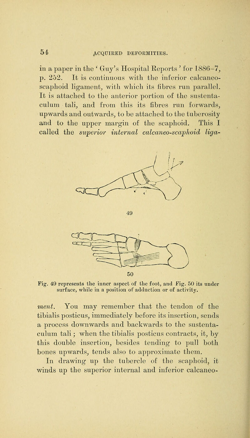 in a paper in tlie ' Griiy's Hospital Reports ' for 1886-7^ p. 252. It is continuous with tlie inferior calcaneo- scaplioid ligament^ with which its fibres run parallel. It is attached to the anterior portion of the sustenta- culum talij and from this its fibres run forwards^ upwards and outwards_, to be attached to the tuberosity and to the upper margin of the scaphoid. This I called the superior internal calcaneo-scaphoid liga- 49 Fig. 49 represents the inner aspect of the foot, and Fig. 50 its under surface, while in a position of adduction or of activity. ment. You may remember that the tendon of the tibialis posticus, immediately before its insertion, sends a process downwards and backwards to the sustenta- culum tali; when the tibialis posticus contracts, it_, by this double insertion, besides tending to pull both bones upwards, tends also to approximate them. In drawing up the tubercle of the scaphoid, it winds up the superior internal and inferior calcaneo-