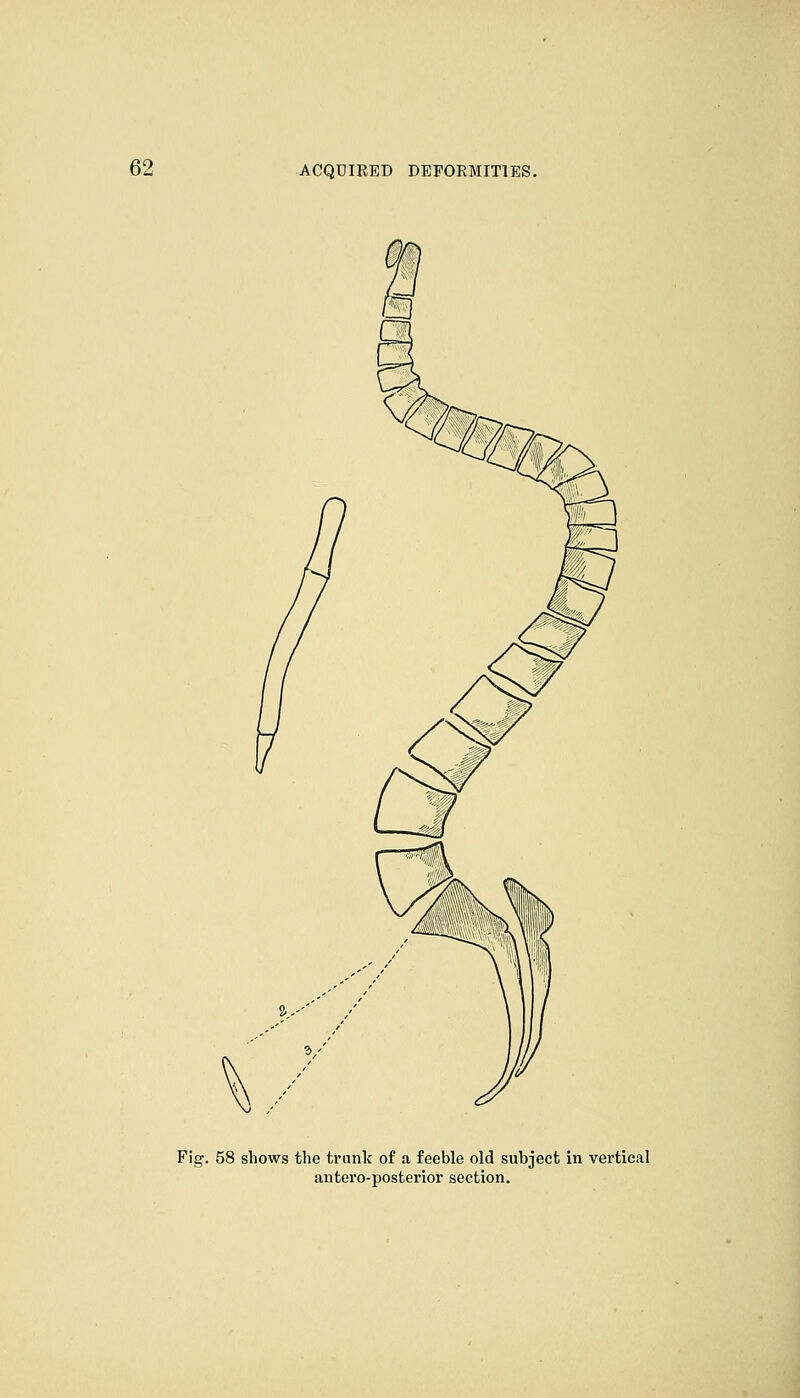 Fig. 58 shows the trunk of a feeble old subject in vertical antero-posterior section.