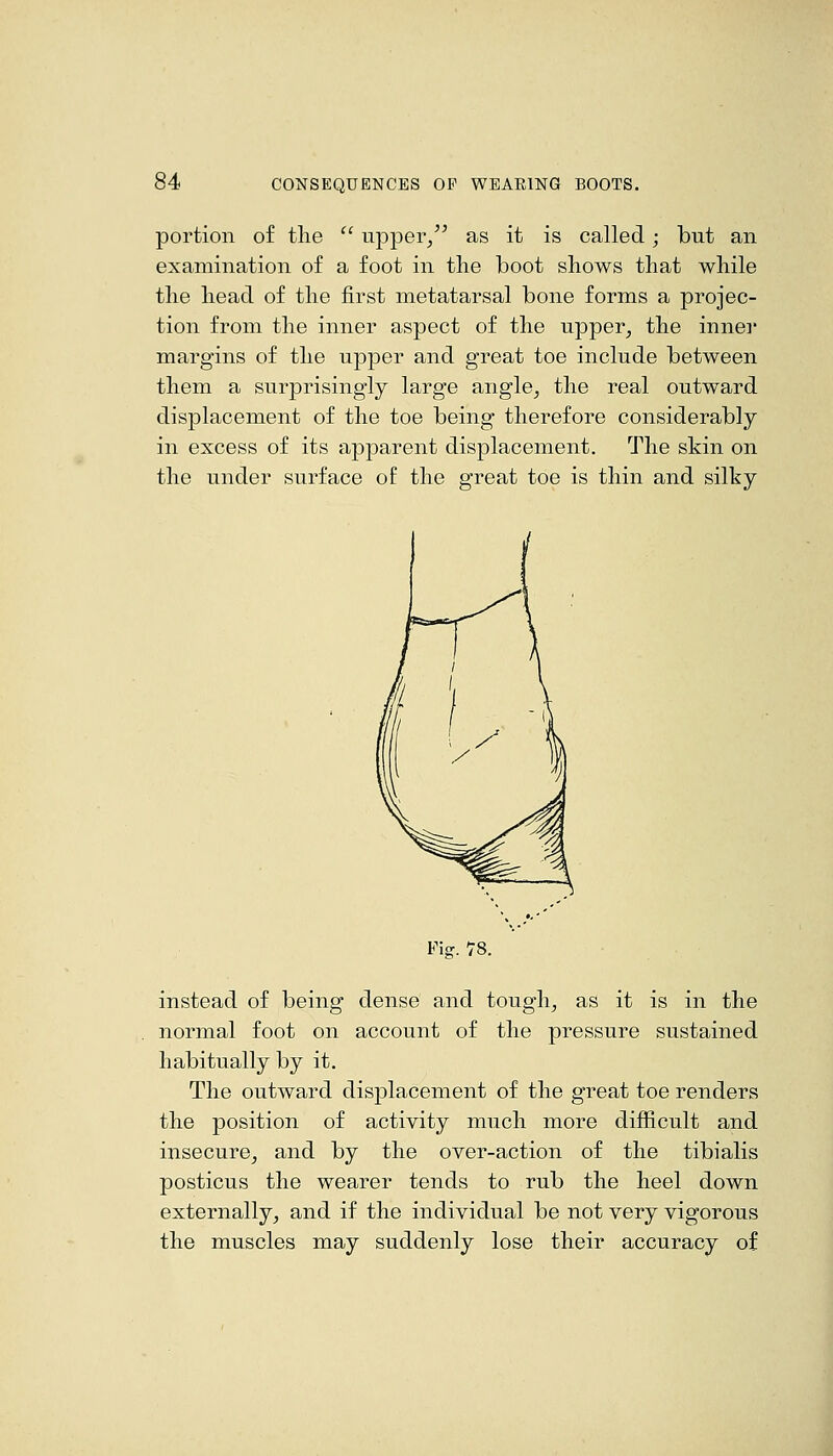 portion of the  upper/^ as it is called; but an examination of a foot in the boot shows that while the head of the first metatarsal bone forms a projec- tion from the inner aspect of the upper, the innei' margins of the upper and great toe include between them a surprisingly large angle, the real outward displacement of the toe being therefore considerably in excess of its apparent displacement. The skin on the under surface of the great toe is thin and silky instead of being dense and tough, as it is in the normal foot on account of the pressure sustained habitually by it. The outward displacement of the great toe renders the position of activity much more difficult and insecure, and by the over-action of the tibialis posticus the wearer tends to rub the heel down externally, and if the individual be not very vigorous the muscles may suddenly lose their accuracy of